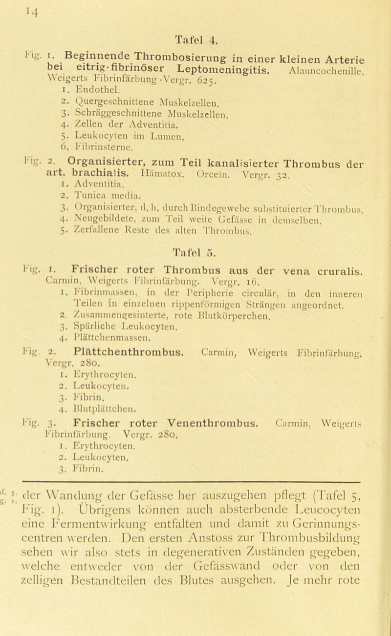 1 ig. i. Beginnende Thrombosierung in einer kleinen Arterie bei eitrig-fibiinöser Leptomeningitis. Alauncochenille, Weigerts Fibrinfärbung-Vergr. 625. 1. Endothel. 2. Quergeschnittene Muskelzellen. 3. Schräggeschnittene Muskelzellen. 4. Zellen der Adventitia. 5. Leukocyten im Lumen. 6. Fibrinsterne. 1 ig. 2. Organisierter, zum Teil kanalisierter Thrombus der art. brachialis. I'Iämatpx, Orcei'n. Vergr. 32. 1. Adventitia. 2. Tunica media. 3. (Irganisierter, d. h. durch Bindegewebe substituierter Thrombus. 4. Neugcbildete, zum Teil weite Gefässe in demselben. 5. Zerfallene Reste des alten Thrombus. Tafel 5. I'ig. 1 • Frischer roter Thrombus aus der vena cruralis. Carmin, Weigerts Fibrinfärbung. Vergr. 16. 1. Fibrinmassen, in der Peripherie circular, in den inneren Teilen in einzelnen rippenförmigen Strängen angeordnet. 2. Zusammengesinterte, rote Blutkörperchen. 3. Spärliche Leukocyten. 4. Plättchenmassen. Fig. 2. Plättchenthrombus. Carmin, Weigerts Fibrinfärbung. Vergr. 280. 1. Erythrocylen. 2. Leukocyten. 3. Fibrin. 4. Blutplättchen. Fig. 3- Frischer roter Venenthrombus. Carmin, Weigerts Fibrinfärbung, Vergr. 280. 1. Erythrocylen. 2. Leukocyten. 3. Fibrin. 5 der Wandung der Gefässe her auszugehen pflegt (Tafel 5, Fig. 1). Übrigens können auch absterbende Leucocyten eine Fermentwirkung entfalten und damit zu Gerinnungs- centren werden. Den ersten Anstoss zur Thrombusbildung sehen wir also stets in degenerativen Zuständen gegeben, welche entweder von der Gefässwand oder von den zelligen Bestandteilen des Blutes ausgehen. Je mehr rote