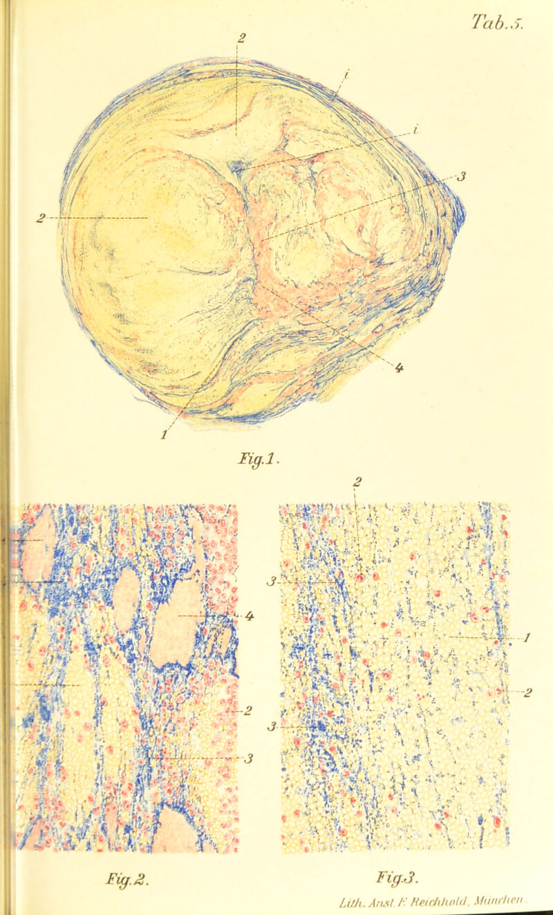 Fig.3. Lüh. Ans! /:' Hetchhold, München