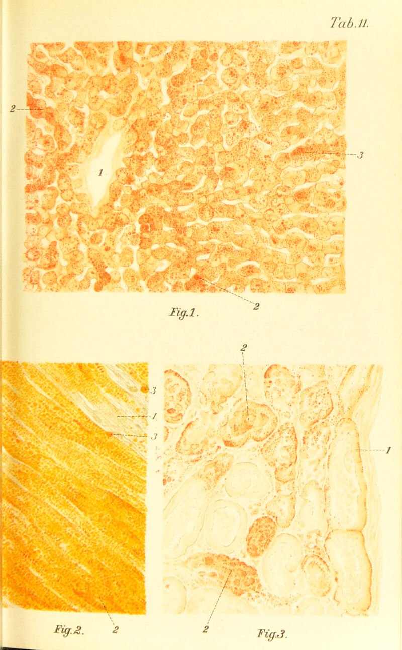 Iig.l. 2 / Fig.3.