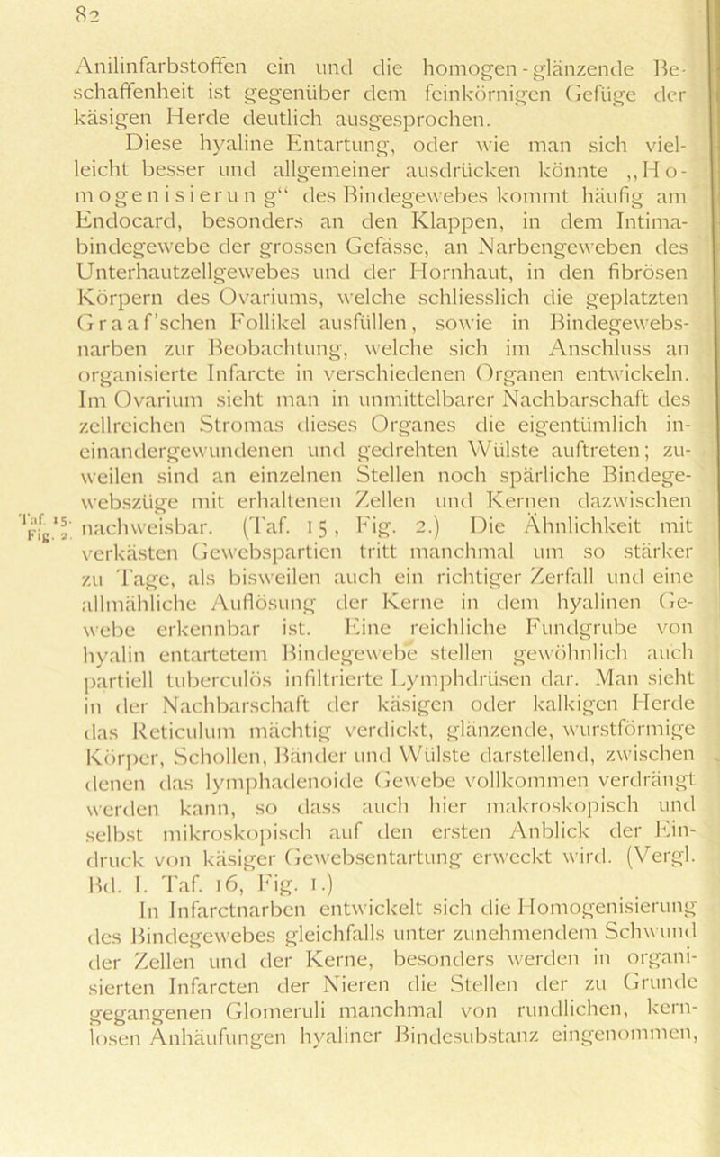 82 Anilinfarbstoffen ein und die homogen - glänzende Be- schaffenheit ist gegenüber dem feinkörnigen Gefüge der käsigen Herde deutlich ausgesprochen. Diese hyaline Entartung, oder wie man sich viel- leicht besser und allgemeiner ausdrücken könnte „Ho- mogenisierung“ des Bindegewebes kommt häufig am Endocard, besonders an den Klappen, in dem Intima- bindegewebe der grossen Gefässe, an Narbengeweben des Unterhautzellgewebes und der Hornhaut, in den fibrösen Körpern des Ovariums, welche schliesslich die geplatzten Graaf'sehen Follikel ausfüllen, sowie in Bindegewebs- narben zur Beobachtung, welche sich im Anschluss an organisierte Infarcte in verschiedenen Organen entwickeln. Im Ovarium sieht man in unmittelbarer Nachbarschaft des zellreichen Stromas dieses Organes die eigentümlich in- einandergewundenen und gedrehten Wülste auftreten; zu- weilen sind an einzelnen Stellen noch spärliche Binclege- webszüge mit erhaltenen Zellen und Kernen dazwischen jg1*' nachweisbar. (Taf. 15, Fig. 2.) Die Ähnlichkeit mit verkästen Gewebspartien tritt manchmal um so stärker zu Tage, als bisweilen auch ein richtiger Zerfall und eine allmähliche Auflösung der Kerne in dem hyalinen Ge- webe erkennbar ist. Eine reichliche Fundgrube von hyalin entartetem Bindegewebe stellen gewöhnlich auch partiell tuberculös infiltrierte Lymphdrtisen dar. Man sieht in der Nachbarschaft der käsigen oder kalkigen Herde das Reticulum mächtig verdickt, glänzende, wurstförmige Körper, Schollen, Bänderund Wülste darstellend, zwischen denen das lymphadenoide Gewebe vollkommen verdrängt werden kann, so dass auch hier makroskopisch und selbst mikroskopisch auf den ersten Anblick der Ein- druck von käsiger Gewebsentartung erweckt wird. (Vergl. Bd. I. Taf. 16, Fig. 1.) In Infarctnarben entwickelt sich die Homogenisierung des Bindegewebes gleichfalls unter zunehmendem Schwund der Zellen und der Kerne, besonders werden in organi- sierten Infarcten der Nieren die Stellen der zu Grunde gegangenen Glomeruli manchmal von rundlichen, kern- losen Anhäufungen hyaliner Bindesubstanz eingenommen,