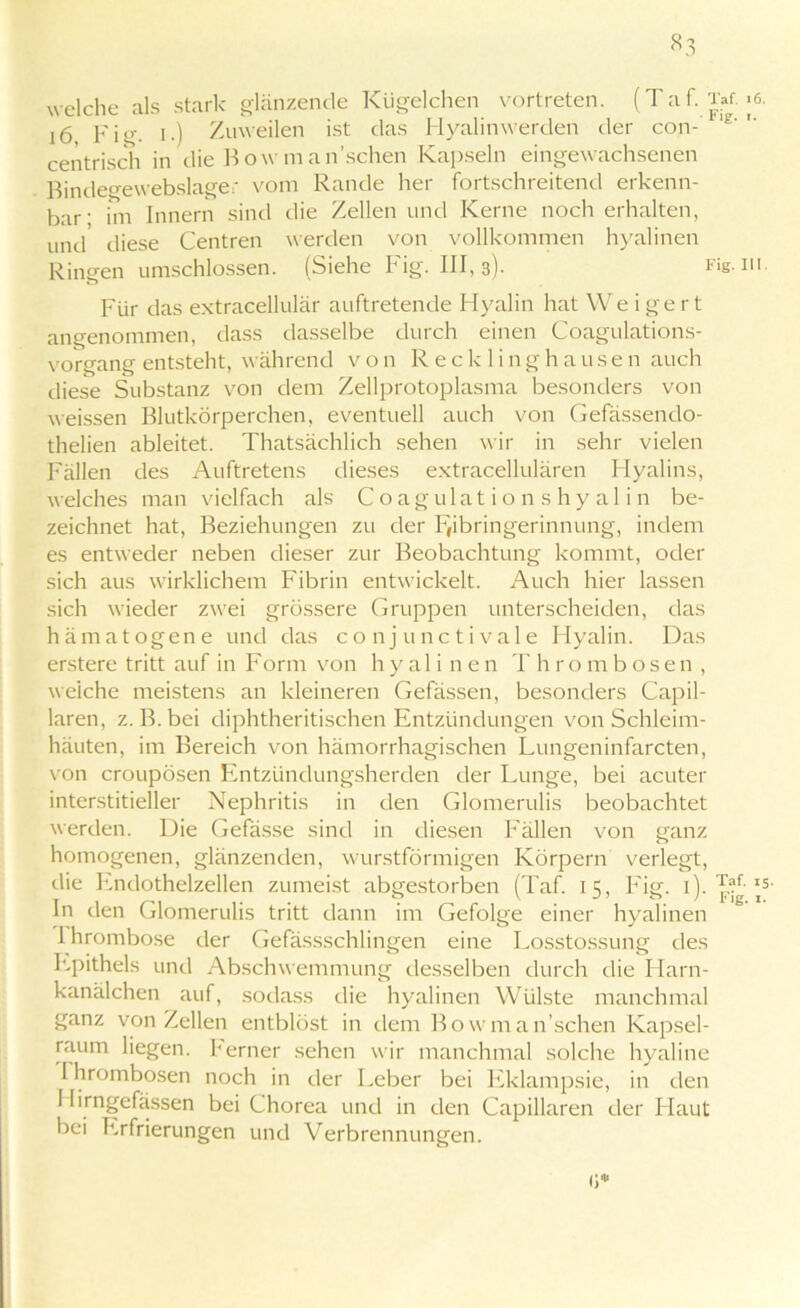 «3 welche als stark glänzende Kügelchen vortreten. (Taf. Taf. >e. Fig. I.) Zuweilen ist das Hyalinwerden der con- ie''' centrisch in die Bow manschen Kapseln eingewachsenen Bindegewebslage; vom Rande her fortschreitend erkenn- bar; im Innern sind die Zellen und Kerne noch erhalten, und' diese Centren werden von vollkommen hyalinen Ringen umschlossen. (Siehe Fig. III, 3). Fig. 111. Für das extracellulär auftretende Hyalin hat We i ge r t angenommen, dass dasselbe durch einen Coagulations- vorgang entsteht, während von R eck 1 i 11 ghausen auch diese Substanz von dem Zellprotoplasma besonders von weissen Blutkörperchen, eventuell auch von Gefässendo- thelien ableitet. Thatsächlich sehen wir in sehr vielen Fällen des Auftretens dieses extracellulären Hyalins, welches man vielfach als Coagulationshyalin be- zeichnet hat, Beziehungen zu der F,ibringerinnung, indem es entweder neben dieser zur Beobachtung kommt, oder sich aus wirklichem Fibrin entwickelt. Auch hier lassen sich wieder zwei grössere Gruppen unterscheiden, das hämatogene und das co nj unctivale Hyalin. Das erstere tritt auf in Form von hyalinen Thrombosen, weiche meistens an kleineren Gefässen, besonders Capil- laren, z. B.bei diphtheritischen Entzündungen von Schleim- häuten, im Bereich von hämorrhagischen Lungeninfarcten, von croupösen Entzündungsherden der Lunge, bei acuter interstitieller Nephritis in den Glomerulis beobachtet werden. Die Gefässe sind in diesen Fällen von ganz homogenen, glänzenden, wurstförmigen Körpern verlegt, die Lndothelzellen zumeist abgestorben (Taf. 15, Fig. 1). '5' In den Glomerulis tritt dann im Gefolge einer hyalinen 1 hrombose der Gefässschlingen eine Losstossung des Epithels und Abschwemmung desselben durch die Harn- kanälchen auf, sodass die hyalinen Wülste manchmal ganz von Zellen entblöst in dem Bowman’schen Kapsel- raum liegen, ferner sehen wir manchmal solche hyaline I hrombosen noch in der Leber bei Eklampsie, in den I lirngefässen bei Chorea und in den Capillaren der Haut bei Erfrierungen und Verbrennungen.