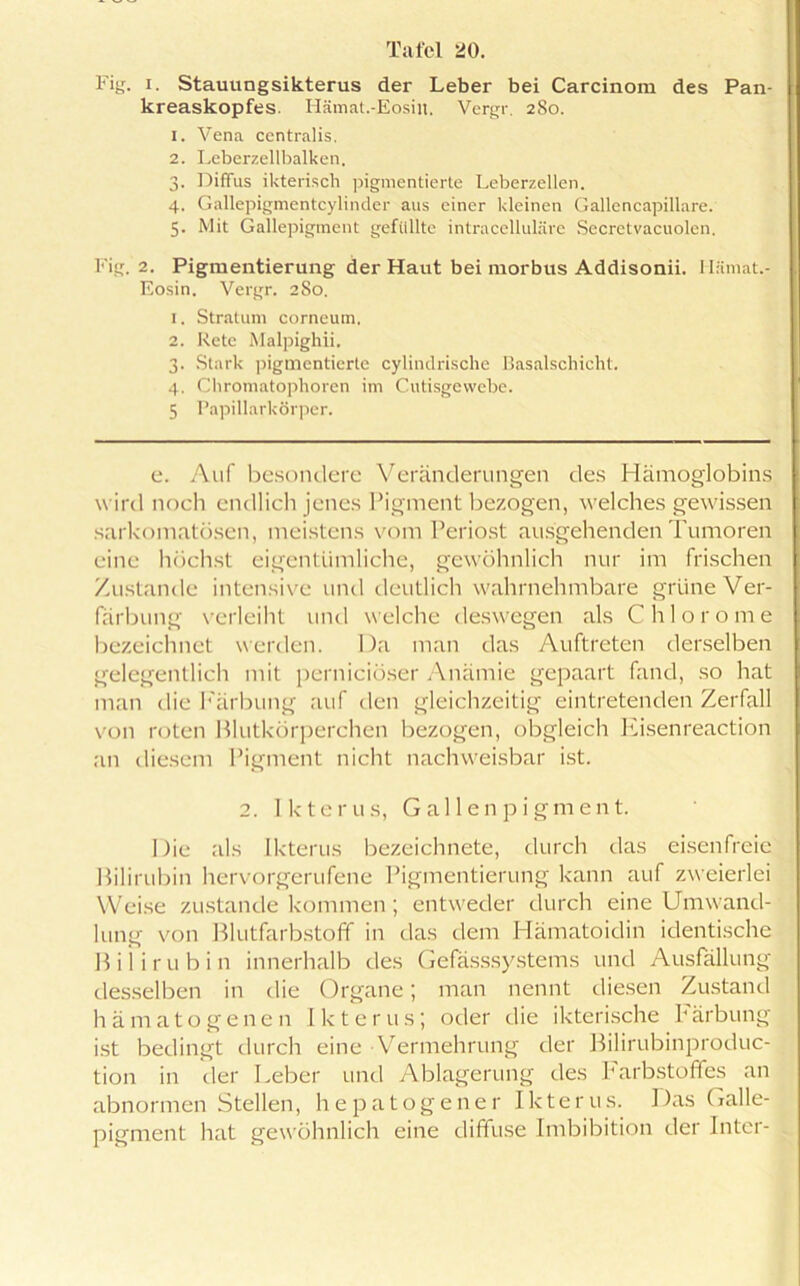 Fig. i. Stauungsikterus der Leber bei Carcinom des Pan- kreaskopfes. Hämat.-Eosiit. Vergr. 280. 1. Vena centralis. 2. Lebcrzellbalken. 3. Diffus ikterisch pigmentierte Leberzellen. 4. Gallepigmentcylinder aus einer kleinen Gallencapillare. 5. Mit Gallepigment gefüllte intracelluläre Secretvacuolen. Fig. 2. Pigmentierung der Haut bei morbus Addisonii. Ilämat.- Eosin. Vergr. 280. 1. Stratum corneum. 2. Rete Malpighii. 3. Stark pigmentierte cylindrische Basalschicht. 4. Chromatophoren im Cutisgewebe. 5 Papillarkörper. e. Auf besondere Veränderungen des Hämoglobins wird noch endlich jenes Pigment bezogen, welches gewissen sarkomatösen, meistens vom Periost ausgehenden Tumoren eine höchst eigentümliche, gewöhnlich nur im frischen Zustande intensive und deutlich wahrnehmbare grüne Ver- färbung verleiht und welche deswegen als Chlorome bezeichnet werden. Da man das Auftreten derselben gelegentlich mit pernieiöser Anämie gepaart fand, so hat man die Färbung auf den gleichzeitig eintretenden Zerfall von roten Blutkörperchen bezogen, obgleich Eisenreaction an diesem Pigment nicht nachweisbar ist. 2. Ikterus, Gallenpigment. Die als Ikterus bezeichnete, durch das eisenfreie Bilirubin hervorgerufene Pigmentierung kann auf zweierlei Weise Zustandekommen; entweder durch eine Umwand- lung von Blutfarbstoff in das dem Hämatoidin identische B i 1 i r u b i n innerhalb des Gefässsystems und Ausfällung desselben in die Organe; man nennt diesen Zustand hämatogenen Ikterus; oder die ikterische bärbung ist bedingt durch eine Vermehrung der Bilirubinproduc- tion in der Leber und Ablagerung des Farbstoffes an abnormen Stellen, hepatogener Ikterus. Das Galle- pigment hat gewöhnlich eine diffuse Imbibition der Inter-