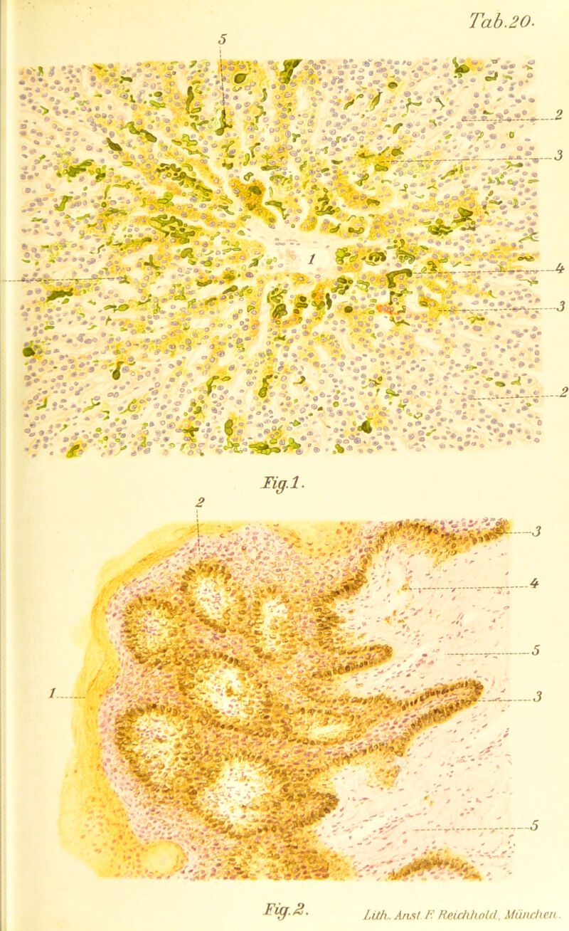 Tab.20 Figl- 2 Fig.2.