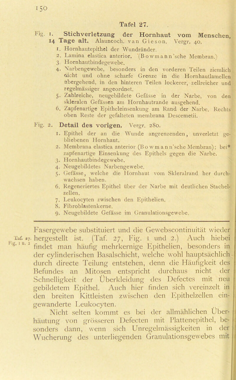 ’ig. 1 u. 2 150 Tafel 27. Fig- >• Stichverletzung der Hornhaut vom Menschen, 14 Tage alt. Alauncoch. van Gieson. Vergr. 40. 1. Hornhautepithel der Wundränder. 2. Lamina elastica anterior. '(B owman n’sche Membran.) 3 Hornhautbindegewebe. 4. Narbengewebe, besonders in den vorderen Teilen ziemlich nicht und ohne scharfe Grenze in die Hornhautlamellen übergehend, in den hinteren Teilen lockerer, zellreicher und regelmässiger angeordnet. 5. Zahlreiche, neugebildete Gefässe in der Narbe, von den skleralen Gefässen am Hornhautrande ausgehend. 6. Zapfenartige Epitheleinsenkung am Rand der Narbe. Rechts oben Reste der gefalteten membrana Descemetii. l'ig. 2. Detail des vorigen. Vergr. 280. 1. Epithel der an die Wunde angrenzenden, unverletzt ge- bliebenen Hornhaut. 2. Membrana elastica anterior (Bo wmann’sche Membran); bei* zapfenartige Einsenkung des Epithels gegen die Narbe. 3. Hornhautbindegewebe. 4. Neugebildetes Narbengewebe. 5. Gefässe, welche die Hornhaut vom Skleralränd her durch- wachsen haben. 6. Regeneriertes Epithel über der Narbe mit deutlichen Stachel- zellen. 7. Leukocyten zwischen den Epithelien. 8. Fibroblastenkerne. 9. Neugebildete Gefässe im Granulationsgewebe. Fasergewebe substituiert und die Gewebscontinuität wieder findet man häufig mehrkernige Epithelien, besonders in der cylinderischen Basalschicht, welche wohl hauptsächlich durch directe Teilung entstehen, denn die Häufigkeit des ; Befundes an Mitosen entspricht durchaus nicht der Schnelligkeit der Überkleidung des Defectes mit neu gebildetem Epithel. Auch hier finden sich vereinzelt in den breiten Kittleisten zwischen den Epithelzellen ein- i gewanderte Leukocyten. Nicht selten kommt es bei der allmählichen Über- häutung von grösseren Defecten mit Plattenepithel, be- sonders dann, wenn sich Unregelmässigkeiten in der Wucherung des unterliegenden Granulationsgewebes mit