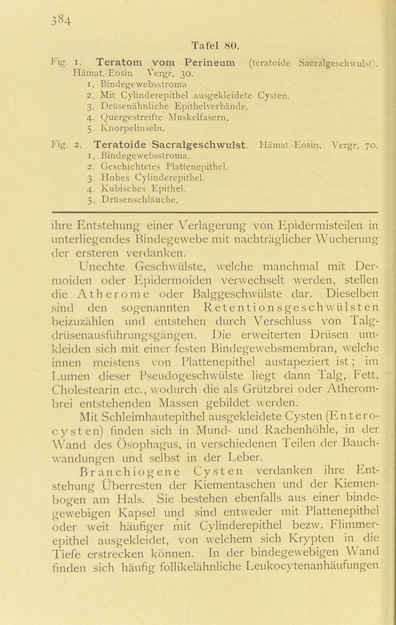 3§4 Tafel 80. Fig. i. Teratom vom Perineum (teratoide Sacralgeschwulst). Hämat.-Eosin Vergr. 30. x. Bindegevvebsstroma 2. Mit Cylinderepithel ausgekleidete Cysten. 3. Drüsenähnliche Epithelverbände. 4. Quergestreifte Muskelfasern. 5. Knorpelinseln. Fig. 2. Teratoide Sacralgeschwulst. Hämat.-Eosin. Vergr. 70. 1. ßindegewebsstroma. 2. Geschichtetes Plattenepithel. 3. Flohes Cylinderepithel. 4. Kubisches Epithel. 5. Drtlsenschläuche. ihre Entstehung einer Verlagerung von Epidermisteilen in unterliegendes Bindegewebe mit nachträglicher Wucherung der ersteren verdanken. Unechte Geschwülste, welche manchmal mit Der- moiden oder Epidermoiden verwechselt werden, stellen die Atherome oder Balggeschwülste dar. Dieselben sind den sogenannten Retentionsgp sch Wülsten beizuzählen und entstehen durch Verschluss von Talg- drüsenausführungsgängen. Die erweiterten Drüsen um- kleiden sich mit einer festen Bindegewebsmembran, welche innen meistens von Plattenepithel austapeziert ist; im Lumen dieser Pseudogeschwülste liegt dann Talg, Fett, Cholestearin etc., wodurch die als Grtitzbrei oder Atherom- brei entstehenden Massen gebildet werden. Mit Schleimhautepithel ausgekleidete Cysten (Entero- cysten) finden sich in Mund- und Rachenhöhle, in der Wand des Ösophagus, in verschiedenen Teilen der Bauch- wandungen und selbst in der Leber. Branchiogene Cysten verdanken ihre Ent- stehung Überresten der Kiementaschen und der Kiemen- bogen am Hals. Sie bestehen ebenfalls aus einer binde- gewebigen Kapsel und sind entweder mit Plattenepithel oder weit häufiger mit Cylinderepithel bezw. Flimmer- epithel ausgekleidet, von welchem sich Krypten in die Tiefe erstrecken können. In der bindegewebigen Wand finden sich häufig follikelähnliche Leukocytenanhäufungen