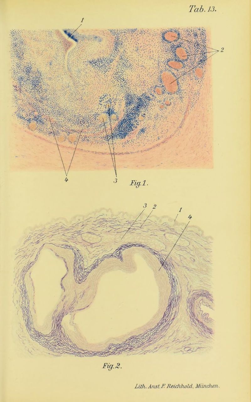 Eig.2. Lüh. Arist.F Reichhold, München .