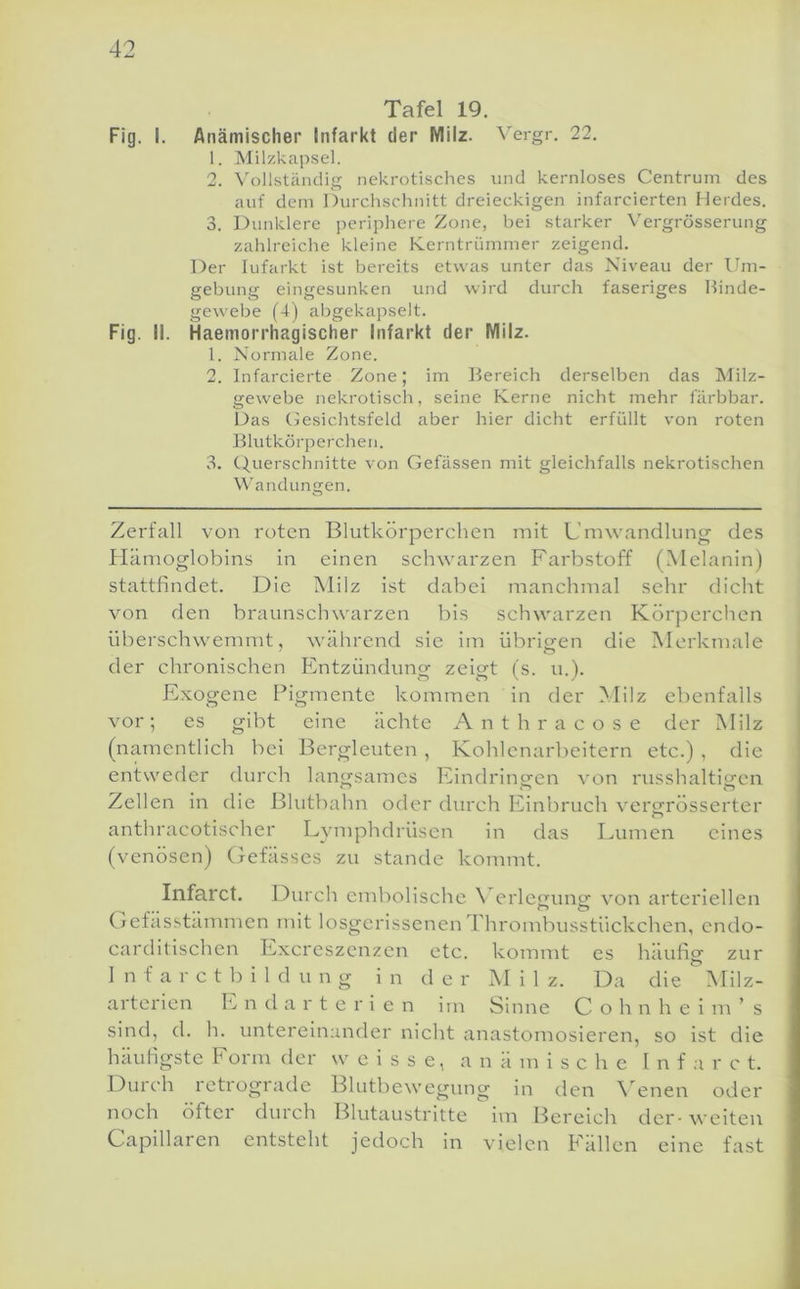 Tafel 19. Fig. I. Anämischer Infarkt der Milz. ^el•gI•. 22. 1. Milzkapsel. 2. Vollständig nekrotisches und kernloses Centrum des auf dem Durchschnitt dreieckigen infarcierten Herdes. 3. Dunklere periphere Zone, bei starker Vergrösserung zahlreiche kleine Kerntrümmer zeigend. Der Infarkt ist bereits etwas unter das Niveau der l.hu- gebung eingesunken und wird durch faseriges llinde- gewebe (4) abgekapselt. Fig. II. Haemorrhagischer Infarkt der Milz. 1. Normale Zone. 2. Infarcierte Zone; im Bereich derselben das Milz- gewebe nekrotisch, seine Kerne nicht mehr färbbar. Das Gesiclitsfeld aber hier dicht erfüllt von roten Blutkörperchen. 3. (Querschnitte von Gefässen mit gleichfalls nekrotischen Wandungen. Zerfall von roten Blutkörperchen mit Umwandlung de.s Hämoglobins in einen schwarzen Farbstoff (Melanin) stattfindet. Die Milz ist dabei manchmal sehr dicht von den braunschwarzen bis schwarzen Körjierchen überschwemmt, während sie im übrigen die Merkmale der chronischen Entzündung zeigt (s. u.). Exogene Pigmente kommen in der Milz ebenfalls vor ; es gibt eine ächte A n t h r a c o s e der Milz (namentlich bei Bergleuten, Kohlenarbeitern etc.), die entweder durch langsames Eindringen von russhaltigen Zellen in die Blutbahn oder durch Einbruch vergrösserter anthracotischer Lymphdrüsen in das Lumen eines (venösen) (jefässes zu stände kommt. Infarct. Durch cmbolischc N erletrung; von arteriellen (jefässtämmen mit losgerissenen Thrombusstückchen, endo- carditischen Exereszenzen etc. kommt es häufig zur 1 n f a r c t 1) i 1 d u n g i n d e r Mil z. Da die ^^ilz- arterien Endarterien im Sinne Cohn he im’s sind, d. h. untereinander nicht anastomosieren, so ist die häufigste Form der w e i s s e, anämische I n f a r c t. Durch retrograde Blutbewegung in den \'enen oder noch öftci durch Blutaustritte im Bereich der- weiten Capillaren entsteht jedoch in vielen Fällen eine fast