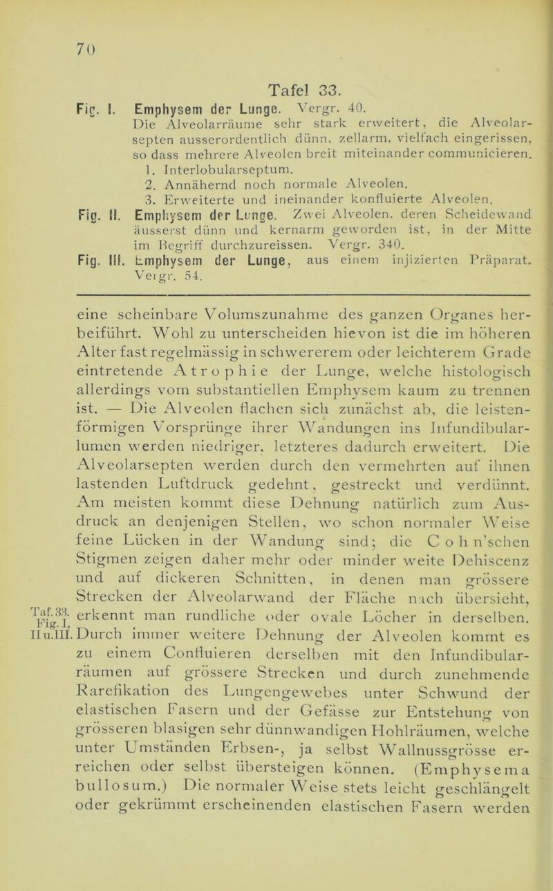 Taf.33. Fig. I, mi.lll. Tafel 33. Fir. I. Emphysem der Lunge. Vcrgr. 40. Die Alveolarräume selir stark erweitert, die Alveolar- septen ausserordentlich dünn, zellarm. vielfach eingerissen, so dass mehrere Alveolen breit miteinander communicieren. 1. Interlobularseptum. 2. Annähernd noch normale vMveolen. 3. Flrweiterte und ineinander konfluierte Alveolen. Fig. II. Empliysem der Lunge. Zwei Alveolen, deren Sclieidewand äusserst dünn und kernarm geworden ist, in der Mitte im Hegriff durchzureissen. Vergr. 340. Fig. III. Lmphysem der Lunge, aus einem injizierten Präparat. Veigr. 54, eine scheinbare Volumszunahme des ganzen Organes lier- beiführt. Wohl zu unterscheiden hiev'on ist die im höheren Alter fast reg-elmässiw in schwererem oder leichterem Grade eintretende Atrophie der I^unge, welche histologisch allerdings vom substantiellen Emphysem kaum zu trennen ist. — Die Alveolen flachen sich zunächst ab, die leisten- förmigen Vorsprünge ihrer Wandungen ins Jnfundibular- lumcn werden niedriger, letzteres dadurch erweitert. Die Alveolarsepten werden durch den vermehrten auf ihnen lastenden Euttdruck gedehnt, gestreckt und verdünnt. Am meisten kommt diese Dehnung natürlich zum Aus- druck an denjenigen Stellen, wo schon normaler Welse feine Lücken in der Wandung sind: die C o h n’schen Stigmen zeigen daher mehr oder minder weite Dehiscenz und auf dickeren Schnitten, in denen man grössere Strecken der xVlveolarwand der Fläche nach übersieht, erkennt man rundliche oder ovale Löcher in derselben. Durch immer weitere löehnung der Alveolen kommt es zu einem Conlluieren derselben mit den Infundibular- räumen auf grössere Strecken und durch zunehmende Rareflkation des Lungengewebes unter Schwund der elastischen h asern und der Gefasse zur Entstehung von grösseren blasigen sehr dünnwandigen Hohlräumen, welche unter Umstfmden Erbsen-, ja selbst Wallnussgrösse er- reichen oder selbst übersteigen können. (Emphysema bullosum.) Die normaler Weise stets leicht geschlängelt oder gekrümmt erscheinenden elastischen Fasern werden