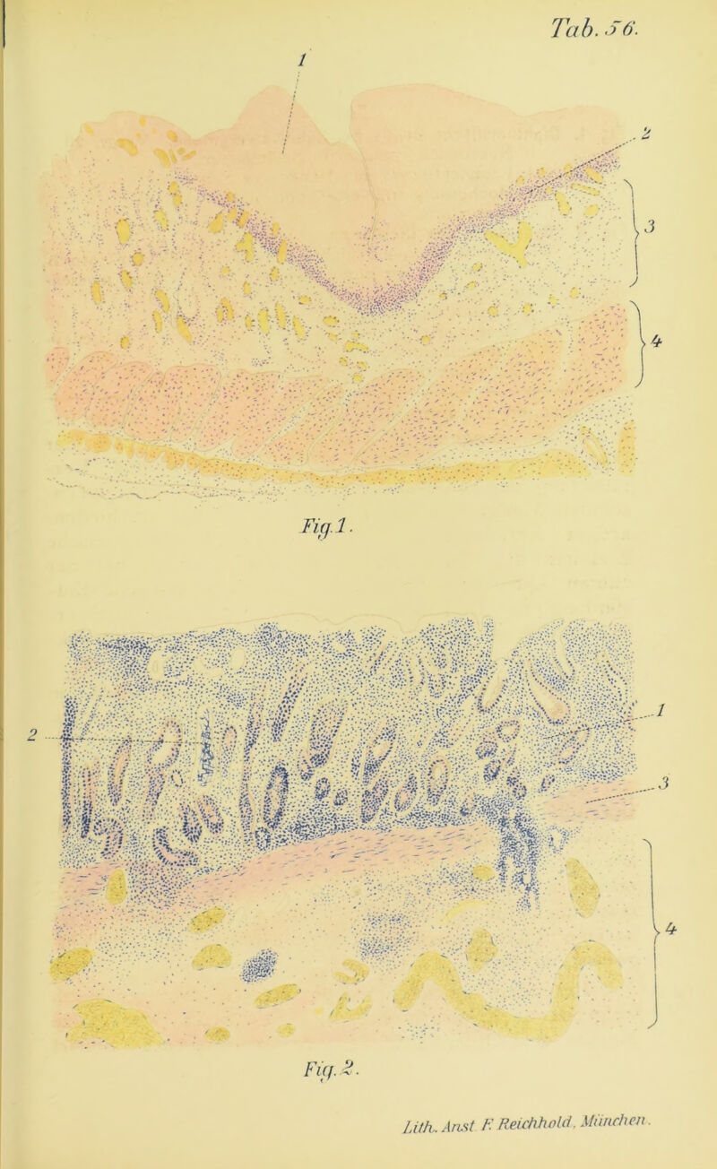 Fuf.^- Lith.Amt K Reichhold. Mimrlmt