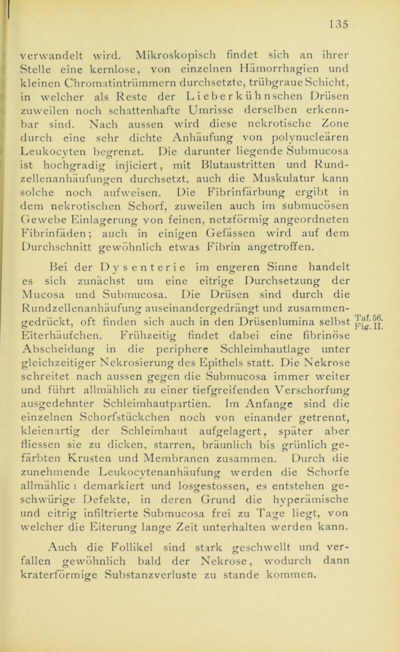 135 verwanflelt wird. Mikroskopisch findet sich an ihrer Stelle eine kernlose, von einzelnen Häinorrhagien und kleinen Chroinatintrürnrnern durchsetzte, trühf^raueSchicht, in welcher als Reste der L i e b e r k ü h n sehen Drüsen zuweilen noch schattenhafte Umrisse derselben erkenn- bar sind. Xach aussen wird diese nekrotische Zone durch eine sehr dichte Anhäufung von ])olynucleären Leukoevten be<»-renzt. Die darunter liegende Subtnucosa ist hochgradig injiciert, mit Blutaustritten und Rund- zellenanhäufungen durchsetzt, auch die Muskulatur kann solche noch aufweisen. Die Fibrinfärbung ergibt in dem nekrotischen Schorf, zuweilen auch im submucösen (xewebe Panlagerung von feinen, netzförmig angeordneten l'ibrinfäden: auch in einigen (jefässen wird auf dem Durchschnitt gewöhnlich etwas P'ibrin ancretroffen. O O Bei der Dysenterie im engeren Sinne handelt es sich zunächst um eine eitrige Durchsetzung der Mucosa und Subtnucosa. Die Drüsen sind durch die Rundzellenanhäufung auseinandergedrängt und zusammen- vedrückt, oft Huden sich auch in den Drüsenlumina selbst Fiterhäufchen. P'rühzeitig Hndet dabei eine fibrinöse Abscheidung in die periphere Schleimhautlage unter gleichzeitiger Nckrosierung des Epithels statt. Die Nekrose schreitet nach aussen gegen die .Subtnucosa immer weiter und führt allmählich zu einer tiefgreifenden Verschorfung ausgedehnter Schleimhautpartien. Im Anfänge sind die einzelnen Schorfstückchen noch von einander getrennt, kleienartig der Schleimhaut aufgelagert, später aber fiiessen sic zu dicken, starren, Vjräunlich bis grünlich ge- färbten Krusten und .Membranen zusammen. Durch die zunehtnende Leukoevtenanhäufuner werden die .Schorfe allmählic i demarkiert und losgestossen, es entstehen ge- schwürige Defekte, in deren (jrund die hyperämische und eitrig infiltrierte .Submucosa frei zu Tage Hegt, von welcher die Eiterung; lanC Zeit unterhalten werden kann. Auch die F'ollikel sind stark geschwellt und ver- fallen gewöhnlich bald der Nekrose, wodurch dann kraterförmige Suf)stanzvcrluste zu stände kommen. Tiif.56 Fi«.II