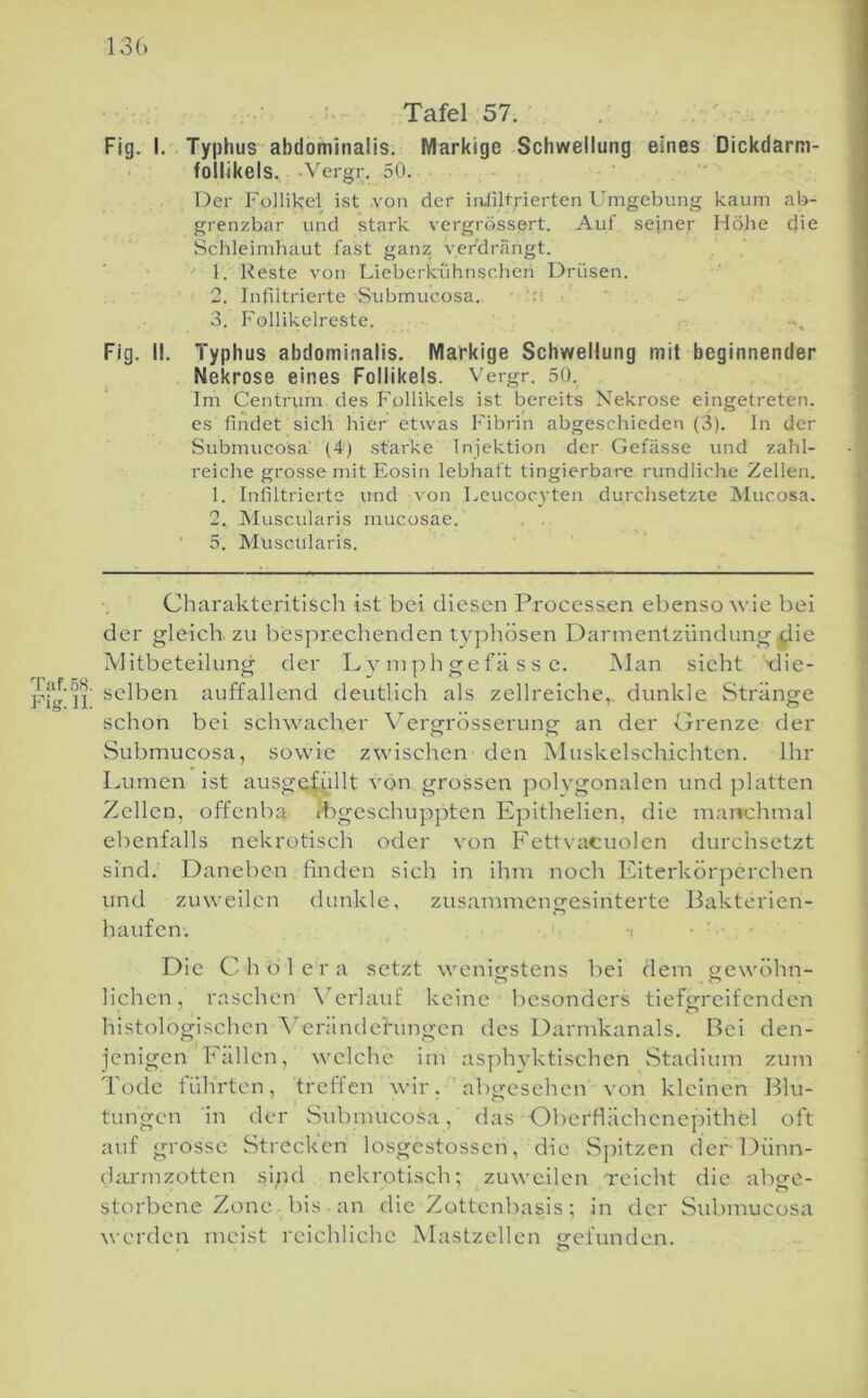 13(. Taf.58. Fig.n. . Tafel 57. Fig. I. - Typhus abdominalis. Markige Schwellung eines Dickdarm- follikels., -Vergr. 50. ' Der Follikel ist von der iiuliltrierten Umgebung kaum ab- grenzbar und stark vergrössert. Aut seiner Höhe die Schleimhaut fast ganz yei'drängt. 1. Reste von Lieberkühnsc.heri Drüsen. 2. Infiltrierte Siibmucosa. .':i ' ; . 3. Follikelreste. Fig. II. Typhus abdominalis. Markige Schwellung mit beginnender Nekrose eines Follikels. Vergr. 50. Im Centrum des Follikels ist bereits Nekrose eingetreten, es findet sicli hier etwas Fibrin abgeschieden (3). In der Submucosa (4j starke Injektion der Gefässe und zahl- reiche grosse mit Eosin lebhaft tingierbare rundliche Zellen. 1. Infiltrierte und von Leucocyten durchsetzte Mucosa. 2., Muscularis mucosae. , . ■ 5. Muscularis. Charakteritisch ist bei diesen Processen ebenso wie bei der gleich zu besprechenden typhösen Darmentzündung ^ie iVJitbeteilung der L y m p h g e f ä s s e. jMan sieht die- selben auffallend deutlich als zellreiche, dunkle Stränge schon bei schwacher \^ero;rösseruno- an der Grenze der Submucosa, sowie zwischen den Muskelschichten. Ihr Lumen ist ausgefullt von grossen polygonalen und platten Zellen, offenba ibgeschuppten Epithelien, die manchmal ebenfalls nekrotisch oder von Fettvacuolen durchsetzt sind. Daneben finden sich in ihm noch Eiterkörperchen und zuweilen dunkle, zusammengesinterte Bakterien- haufen. Die Cholera setzt wenig-stens bei dem gewöhn- liehen, raschen \^erlauf keine besonders tiefgreifenden histologischen V’erändehingen des Darmkanals. Bei den- jenigen Fällen, welche im asphvktischen Stadium zum Tode führten, treffen wir. 'abgesehen von kleinen Blu- tungen in der Siibmucosa, das Obcrflächcnepithel oft auf grosse Strecken losgcstossen, die Spitzen der Dünn- darmzotten sipd nekrotisch; zuweilen Tcicht die abge- storbene Zone bis an die Zottenbasis; in der Submucosa werden meist reichliche Mastzcllen gefunden.