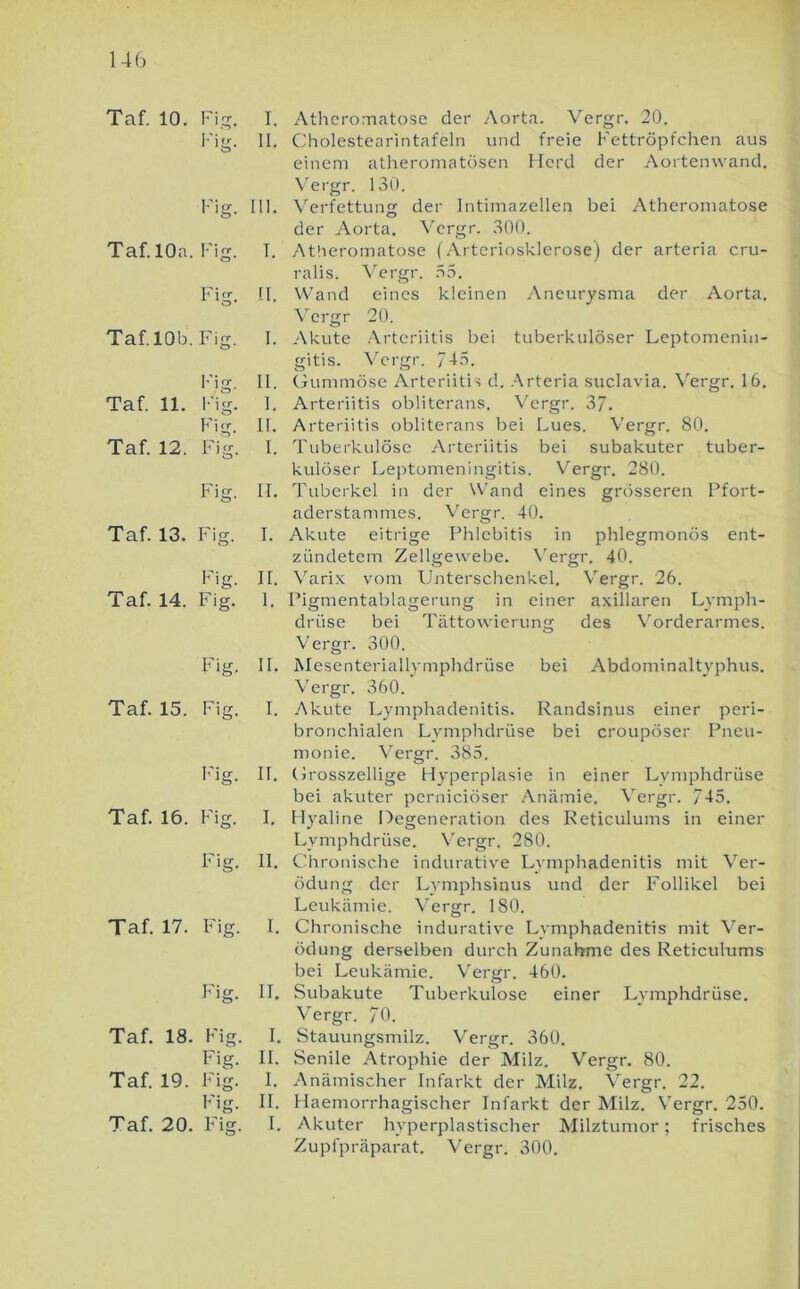 Taf. 10. Fi.jr. Taf. 10a. Fig. Fig. Taf. 10b. Fig. I'ig. Taf. 11. l-'ig. Fig. Taf. 12. Fig. Fig. Taf. 13. Fig. Fig. Taf. 14. Fig. Fig. Taf. 15. Fig. Taf. 16. Fig. Fig. Taf. 17. Fig. Fig. Taf. 18. Fig. Fig. Taf. 19. Fig. Fig. Taf. 20. Fig. I. Atheromatose der Aorta. Vergr. 20. II. Cholestearintafeln und freie Fettröpfchen aus einem atheromatösen Herd der Aortenwand. N'ei'gr. 130. 111. \erfettung der Intimazellen bei Atheromatose der Aorta. Vergr. 300. T. Atheromatose (Arteriosklerose) der arteria cru- ralis. Vergr. .35. II. Wand eines kleinen Aneurysma der Aorta. ^ergr 20. I. Akute Arteriitis bei tuberkulöser Leptomenin- gitis. Vergr. Jlö. II. Gummöse Arteriitis d. .-\rteria suclavia. Vergr. 16. I. Arteriitis obliterans. Vergr. 37. II. Arteriitis obliterans bei Lues. Vergr. 80. I. Tuberkulöse Arteriitis bei subakuter tuber- kulöser Leptomeningitis. V'ergr. 280. II. Tuberkel in der Wand eines grösseren Pfort- aderstammes. Vergr. 40. I. Akute eitrige Phlebitis in phlegmonös ent- zündetem Zellgewebe. Vergr. 40. II. Varix vom Unterschenkel. Vergr. 26. I. Pigmentablagerung in einer axillaren Lymph- driise bei Tättowierung des Vorderarmes. Vergr. 300. II. Mesentei'iallymphdrüse bei Abdominaltyphus. Vergr. 360. I. Akute Lymphadenitis. Randsinus einer peri- bronchialen Lymphdrüse bei croupöser Pneu- monie. Vergr. 385. II. Grosszellige Hyperplasie in einer Lymphdrüse bei akuter perniciöser Ancämie. Vergr. 745. I. Hyaline Degeneration des Reticulums in einer Lymphdrüse. \ergr. 280. II. Chronische indurative Lymphadenitis mit Ver- ödung der Lymphsinus und der Follikel bei Leukämie. \'ergr. 180. I. Chronische indurative Lymphadenitis mit Ver- ödung derselben durch Zunahme des Reticulums bei Leukämie. V'ergr. 460. II. Subakute Tuberkulose einer Lymphdrüse. Vergr. 70. I. Stauungsmilz. Vergr. 360. II. Senile Atrophie der Milz. Vergr. 80. I. Anämischer Infarkt der Milz. Vergr. 22. II. Haemorrhagischer Infarkt der Milz. Vergr. 250. I. Akuter hyperplastischer Milztumor; frisches Zupfpräparat. Vergr. 300.