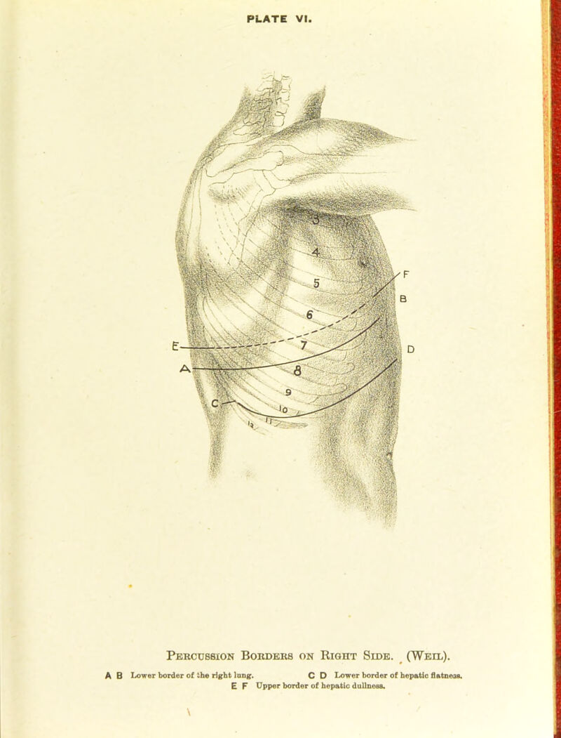 Percussion Borders on Right Side. _ (Weil). A 6 Lower border of the right Inog. C D Lower border of hepatic flatness. E F Upper border of hepatic dullness.