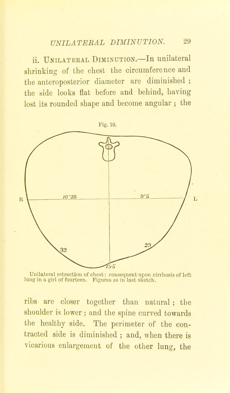 ii. Unilateral Diminution.—In unilateral shrinking of the chest the circumference and the anteroposterior diameter are diminished ; the side looks flat before and behind, having lost its rounded shape and become angular ; the Fig. 10. Unilateral retraction of chest: consequent upon cirrhosis of left lung in a girl of fourteen. Figures as in last sketch. ribs are closer together than natural ; the shoulder is lower ; and the spine curved towards tlie healthy side. The perimeter of the con- tracted side is diminished ; and, when there is vicarious enlargement of the other lung, the