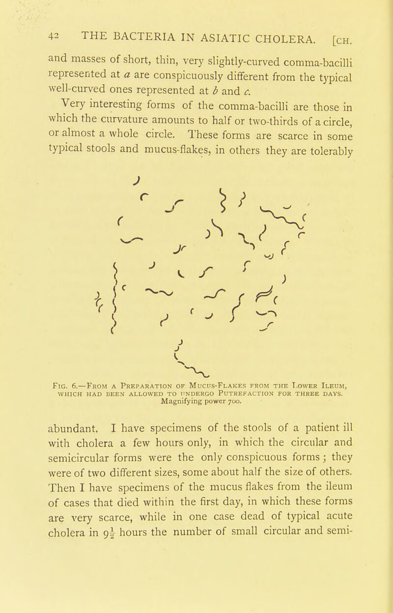 and masses of short, thin, very shghtly-curved comma-bacilli represented at a are conspicuously different from the typical well-curved ones represented at b and c. Very interesting forms of the comma-bacilli are those in which the curvature amounts to half or two-thirds of a circle, or almost a whole circle. These forms are scarce in some typical stools and mucus-flakes, in others they are tolerably J J Fig. 6.—From a Preparation of Mucus-Flakes from the T.ower Ileum, WHICH had been allowed to undergo Putrefaction for three days. Magnifying power 700. abundant. I have specimens of the stools of a patient ill with cholera a few hours only, in which the circular and semicircular forms were the only conspicuous forms ; they were of two different sizes, some about half the size of others. Then I have specimens of the mucus flakes from the ileum of cases that died within the first day, in which these forms are very scarce, while in one case dead of typical acute cholera in 9-^- hours the number of small circular and semi-