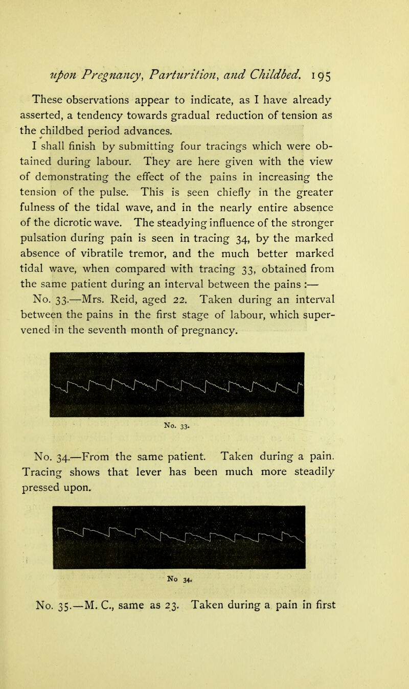 These observations appear to indicate, as I have already asserted, a tendency towards gradual reduction of tension as the childbed period advances. I shall finish by submitting four tracings which were ob- tained during labour. They are here given with the view of demonstrating the effect of the pains in increasing the tension of the pulse. This is seen chiefly in the greater fulness of the tidal wave, and in the nearly entire absence of the dicrotic wave. The steadying influence of the stronger pulsation during pain is seen in tracing 34, by the marked absence of vibratile tremor, and the much better marked tidal wave, when compared with tracing 33, obtained from the same patient during an interval between the pains :— No. 33.—Mrs. Reid, aged 22. Taken during an interval between the pains in the first stage of labour, which super- vened in the seventh month of pregnancy. No. 34.—From the same patient. Taken during a pain. Tracing shows that lever has been much more steadily pressed upon. No 34. No. 35.—M. C, same as 23. Taken during a pain in first