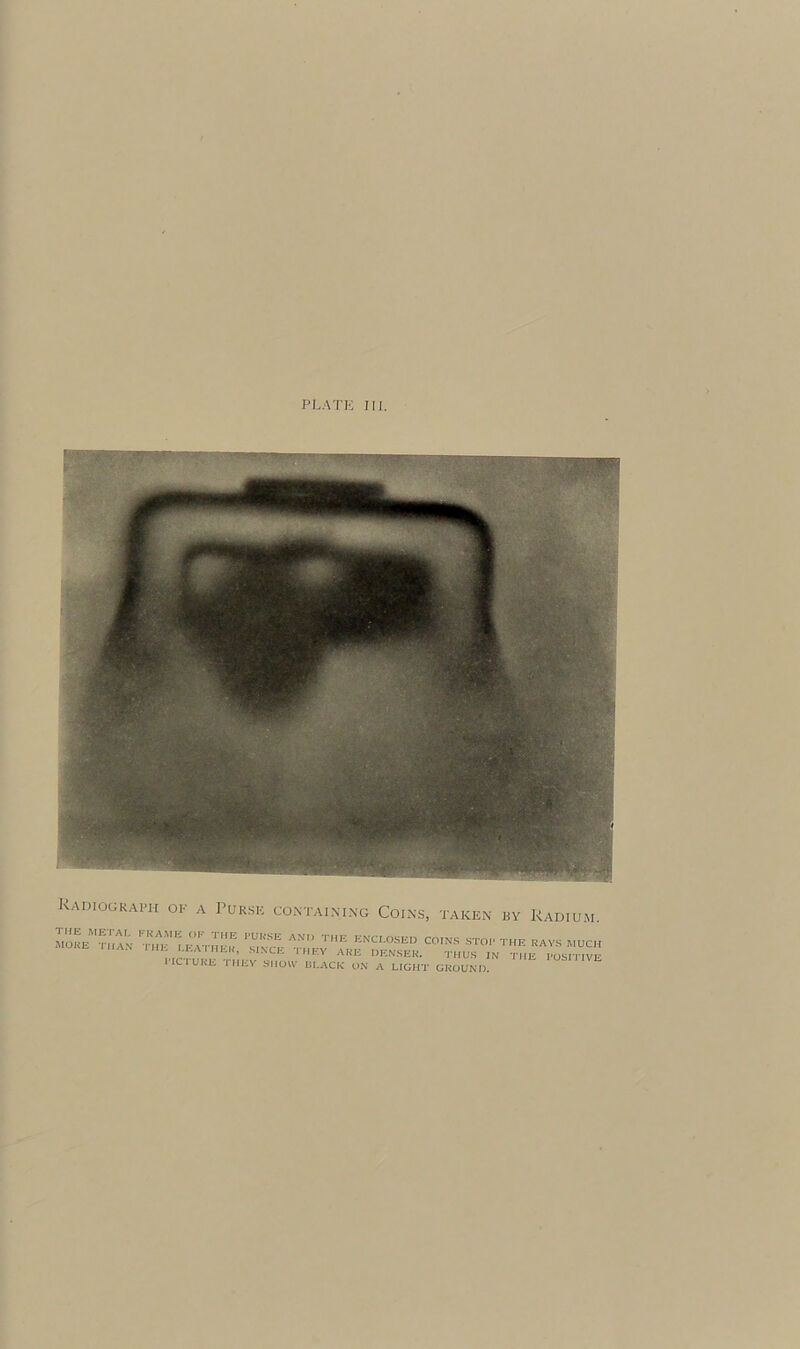 Radiograph of a Purse containing Coins, taken by Radium ICT URL. I HIiV SHOW SLACK ON A LIGHT GROUND.