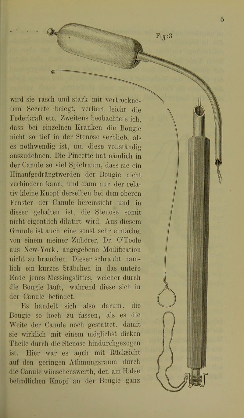 wird sie rasch und stark mit vertrockne- tem Secrete belegt, verliert leicht die Federkraft etc. Zweitens beobachtete ich, dass bei einzelnen Kranken die Bougie nicht so tief in der Stenose verblieb, als es notliwendig ist, um diese vollständig auszudehnen. Die Pincette hat nämlich in der Canule so viel Spielraum, dass sie ein Hinaufgedrängtwerden der Bougie nicht verhindern kann, und dann nur der rela- tiv kleine Knopf derselben bei dem oberen Fenster der Canule hereinsieht und in dieser gehalten ist, die Stenose somit nicht eigentlich dilatirt wird. Aus diesem Grunde ist auch eine sonst sehr einfache, von einem meiner Zuhörer, Dr. O'Toole aus New-York, angegebene Modilication nicht zu brauchen. Dieser schraubt näm- lich ein kurzes Stäbchen in das untere Ende jenes Messingstiftes, welcher durch die Bougie läuft, während diese sich in der Canule befindet. Es handelt sich also darum, die Bougie so hoch zu fassen, als es die Weite der Canule noch gestattet, damit sie wirklich mit einem möglichst dicken Theile durch die Stenose hindurchgezogen ist. Hier war es auch mit Rücksicht auf den geringen Athmungsraum durch die Canule wünschenswerth, den am Halse befindlichen Knopf an der Bougie ganz