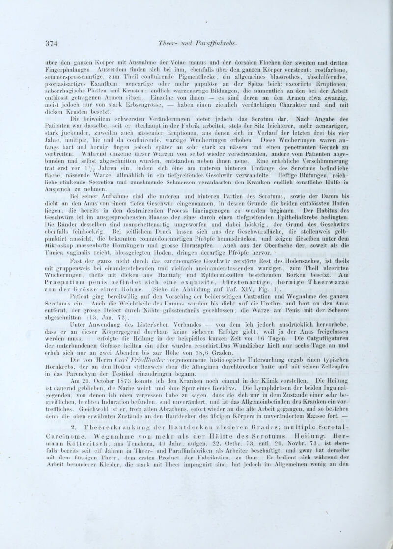 iibnr den ganzen Körper mit Ansnahme der Volae raanns nnd der dorsalen Flächen der zweiten nnd dritten Fingcrplialangen. Ansserdcui finden sicii bei ihm, ebenfalls über den ganzen Körper verstreut: rostfarbene, somniersprossenartige, zum Tlicil eonfluirende Pigmentflecke, ein allgemeines blassrotlies, abschilferndes, psoriasisurtiges Exanthem. aeneartige oder mehr papuhise an der Spitze leicht excoriirte Eruptionen, scborrhagische Platten und Ki'usten ; endlich warzenartige Bildungen, die namentlicli au den bei der Arbeit entblüsst getragenen Armen sitzen. Einzc'ne von ihnen — es sind deren au den Armeu etwa zwanzig, meist jedoch nur von stark Erbsengrösse, — haben einen ziemlicli verdächtigen Charakter und sind mit dicken Krusten besetzt. Die beiweitera scliwersten Veränderungen bietet Jedocli das Scrotum dar. Nach Angabe des Patienten war da.^selbe, seit er überhaupt in der F.ibrik arbeitet, stets der Sitz leichterer, mehr acneartiger, stark juckender, zuweilen auch nässender Eruptionen, aus denen sich im Verlauf der letzten drei bis vier Jahre, multiijle, hie und da confluirende, warzige Wucherungen erhoben Diese Wucherungen waren an- fangs hart und hornig, fingen jedoch spätei- an sehr stark zu nässen und einen penetranten Geruch zu verbreiten. Während einzelne dieser Warzen von selbst wieder verschwanden, andere vom Patienten abge- bunden und selbst abgeschnitten wurden, entstanden nebeu ihnen neue. Eiue erhebliche Verschlimmerung trat erst vor l'y^ -Tahren ein, indem sich eine am unteren hinteren Umfange des Scrotums befindliche flache, nässende Warze, allmählich in ein tiefgreifendes Geschwür verwandelte. Heftige Blutungen, reich- liche stinkende Secretion und zunehmende Schmerzen veranlassten den Kranken endlich ernstliclie Hülfe in Anspruch zu nehmen. Bei seiner Aufnahme sind die unteren und hinteren Partien des Scrotums, sowie der Damm bis dicht au den Anus von einem tiefen Gescliwür eingenommen, in dessen Grunde die beiden entbhissten Hoden liegen, die bereits in den destruirenden Process liineingezogen zu werden beginnen. Der Habitus des Geschwürs ist im ausgesprochensten Maasse der eines durch einen tiefgreifenden Epithelialkrebs bedingten. Die Ränder desselben sind uianscliettenartig umgeworfen und dabei höclirig, der Grund des Gescliwiirs ebenfalls feiuhöckrig. Bei seitlichem Druck lassen sich aus der Geschwürsfläche, die stellenweis gelb- punktirt aussieht, die bekannten commedoiienartigen Pfröpfe herausdrücken, und zeigen dieselben unter dem •Mikroskop massenhafte Hornkugeln nnd grosse Horuzapfen. Auch aus der Oberfläche der, soweit als die 'I'unica vaginalis reicht, blossgelcgten Hoden, dringen derartige Pfröpfe hervor. Fast der ganze nicht durch das carciuomatöse Geschwür zerstörte Rest des Ilodensackes, ist theils mit grappenweis bei cinandeisteheuden und vielfach aneiiianderstossenden warzigen, zum Theil uleerirten Wucherungen, theils mit dicken aus Hauttalg und P^pideimiszellen bestehenden Borken besetzt. Am Praeputium penis befindet sich eiue exquisite, bür s t eu ar ti ge , hornige Theerwarze von der Grösse einer Bohne. (Siehe die Abbildung auf Taf. XIV, Fig. 1'. Patient ging bereitwillig auf den Vorschlag der beiderseitigen Castration und Wegnalnne des ganzen Scrotum s ein. Auch die Weichtheile des Damms wurden bis dicht auf die Urethra und hart an den Anus entfernt, der grosse Defect durch Nähte grösstentheils geschlossen: die Warze am ]*enis mit der Scheei-e abgeschnitten. \\\\. Jan. 73). Unter Anwendung des Lister'schen Verbandes — von dem ich jedoch ausdrücklich hervorliebe. dass er an dieser Krupergegend durchaus keine sicheren Erfolge giebt, weil ja der Anus freigelas.scn werden muss, — erfolgte die Heilung in der beispiellos kurzen Zeit von 1B Tagen. Die Catgutligaturen der unterbundenen Gefässe heilten ein oder wurdeu resorbirt.Das Wundfieber liielt nur sechs Tage an und erhob sicli nur an zwei Abenden bis zur Höhe von ;^S,() Graden. Die von Herrn Carl Frirdlämhr vorgenonnnene histiologische l'ntersnchung ergab einen fy])ischen H(U-nkrel)S, der an den Hoden siellenweis eben die Albuginea durclibroclien hatte und mit seinen Zellzapfeu in das Parenchym der Testikel einzudringen begann. Am 29. October 1873 konnte ich den Kranken noch einmal in der Klinik vorstellen. Die Heilung ist dauernd geblieben, die Narbe weich und ohne Spur eines Recidivs. Die Lymphdrüsen der beiden Inguinal- gegenden, von denen ich oben vergessen habe zu sagen, dass sie sich nur in dem Znstande einer sehr be- greiflichen, leiditen Induration befanden, sind unverändert, und ist das Allgemeinbefinden des Kranken ein vor- trefl'liclies. Gleidiwohl ist er, trotz allen Abrathens, sofort wieder an die alte Arbeit gegangen, und so be^tehen denn die oben ei wähnten Zustände an den Hautdecken des übrigen Körpers in unverändertem Maasse fort. — 2. Theer c rk r an k 1111 i;' der Hautdecken niederen Grades; multiple Serotal- Carciuoine. Wegiiahiiic von mehr als der Hälfte des Serotunis. Heilung. Her- mann Kötteritsch, aus Teuchern, A\) Jahr, aufgeu. 22. Octbr. 73, entl. 2(t. Novbr. 73, ist eben- falls bereits seit elf Jahren in Theer- und Paraffinfabrikeu als Arbeiter bescliäftigt, und zwar hat derselbe mit dem flüssigen 'i'heer, dem ersten Prodnct der Fabrikation, zu thun. Er bedient sich während der Arbeit besonderer Kleider, die stark mit Theer imprägnirt sind, hat jedoch im .Allgemeinen wenig an den