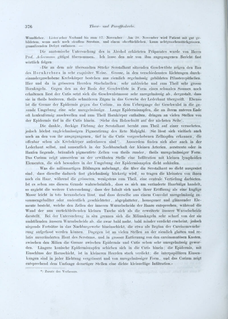 Wiiiidfiflier. Listcr scIicr Vcibiuid biy ziiiii 17. November. Am 'in. November wird Patient mit gut ge- bildetem, wenn iuicii noch .straHeiu Scrotiun, imd eiuem obcrtiiichlielieii. kaum aelifgrosclieiistückgrossen. granulirenden Defect entlassen. — Die auatomisclie Untersuchung des in Alcohol erhärteten Präparates wurde von Herrn Prof. Avhermunn gütigst ii))ernonnneu. Ich lasse den mir von ihm zugegangenen Bericht fast wörtlich folgen: »Die an dem mir übersandten Stücke Scrotalhaut sitzenden Geschwülste zeigen den Bau des Tlorukrebses in sclir exquisiter Weise. Grosse, in den verschiedensten Richtungen durch- einandergeschobene Krebskörper bestehen aus ziemlich regelmässig gebildeten Pflasterci)ithelien. Hier und da in grösseren Heerden Stachelzelleu; sehr zaldreiche und zum Theil sehr grosse llornkugeln. Gegen den an der Basis der Geschwülste in Form eines schmalen Saumes noch erhaltenen Kest der Cutis setzt sich die Geschwulstmasse sehr unregelniässig ab. dergestalt, dass sie in theils breiteren, theils schmäleren Zügen in das Gewebe der Ledorliaut übergreift. Ebenso ist die Grenze der Epidermis gegen das Corium. an dem Uebergauge der Geschwulst in die ge- sunde Umgebung eine sehr unregelmässige. Lange Epidermiszapfen, die an ihrem unteren Ende oft keulenförmig anschwellen und zum Theil Hornkörper enthalten, dringen an vielen Stellen von der Epidermis tief in die Cutis hinein. (Siehe den Holzschnitt auf der nächsten Seite'. Die dunkle, fleckige Färbung der Scrotalhaut beruht zum Theil auf einer vermehrten, jedoch höchst ungleichmässigen Pigmentirung des Kete ]\Ialpighi. Sie lässt sich vielfach auch noch an den von ihr ausgegangenen, tief in die Cutis vorgeschobenen Zellzapfen erkennen, die oifenbar schon als Krebskörper aufzufassen sind;. Ausserdem finden sich aber auch in der Lederhaut selbst, und namentlich in der Nachbarschaft der kleineu Arterien, zerstreute oder in Haufen liegende, bräunlich pigmentirtc Zellen von theils runder, theils unregelmässiger Form. Das Corium zeigt ausserdem an der erwähnten Stelle eine Infiltration mit kleinen lymphoiden Elementen, die sich besonders in der Umgebung der Eindermiszajjfen dicht anhäufen. Was die miliumartigeu Bildungen anbelangt, die über die Scrotalhaut so dicht ausgesäet sind, dass dieselbe dadurch fast gleichmässig höckerig wird, so tragen die kleinsten Aon ihnen noch ein Haar, während die grösseren, wenigstens zum Theil, eine centrale Vertiefung darbieten. Ist es schon aus diesem Grunde wahrscheinlich, dass es sich um veränderte Haarbälge handelt, so ergiebt die weitere Untersuchung, dass der Inhalt sich nach ihrer Eröffnung als eine kuglige Masse leicht in toto herausheben lässt. und dass derselbe aus einem Convolut unregelraässig zu- sammengeballter oder undeutlich geschichteter, aljgeplatteter, homogener und glänzender Ele- mente besteht, welche den Zellen der inneren Wurzelscheide der Haare entsprechen, während die Wand der nun zurUckbleil)cnden kleinen Tasche sich als die erweiterte äussere Wurzelscheide darstellt. Bei der Untersuchung in situ grenzen sich die Milimid^ugelu sehr scharf von der sie umhüllenden äussern Wurzelscheide ab. die zwar bald mehr. l)ald minder verdickt erscheint, jedoch nirgends Fortsätze in das Nachbargewebe hineinschickt, die etwa als Beginn der Carcinomwuche- rung aufgefasst werden können. Dagegen ist an vielen Stellen an der ziendich glatten und re- lativ unveränderten Haut des Scrotunis, und in grosser Entfernung von den carcinomatösen Knoten, zwischen den Milien die Grenze zwischen Epidermis und Cutis schon sehr unregelmässig gewor- den. Längere konische Epidermiszapfen schieben sich in die Cutis hinein: die Epidermis, mit Einschluss der Hornschicht, ist in kleineren Heerden stark \erdickt: die interpapillären Einsen- kungen sind in jeder Richtung vergrössert und von unregelmässiger Form. und das Corium zeigt entsprechend dem Umfange derartiger Stellen eine dichte kleinzellige Infiltration.» *) Zusatz des Verfassers.