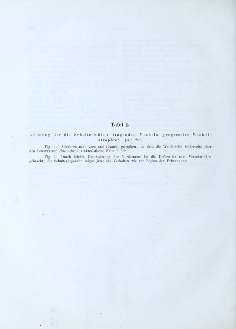 Lähmung der die Schulterblätter tragenden Muskeln (progressive Muskel- atrophie? , pag. '206. Fig. 1. Schultern nach vorn und abwärts gesunken, so dass die Weichtheile beiderseits über den Brustwarzen eine sehr charakteristische Falte bilden. Fig. 2. Durch leichte Unterstützung der Vorderarme ist die Deformität zum Verschwinden gebracht; die Schultergegenden zeigen jetzt das Verhalten wie vor Beginn der Erkrankung.