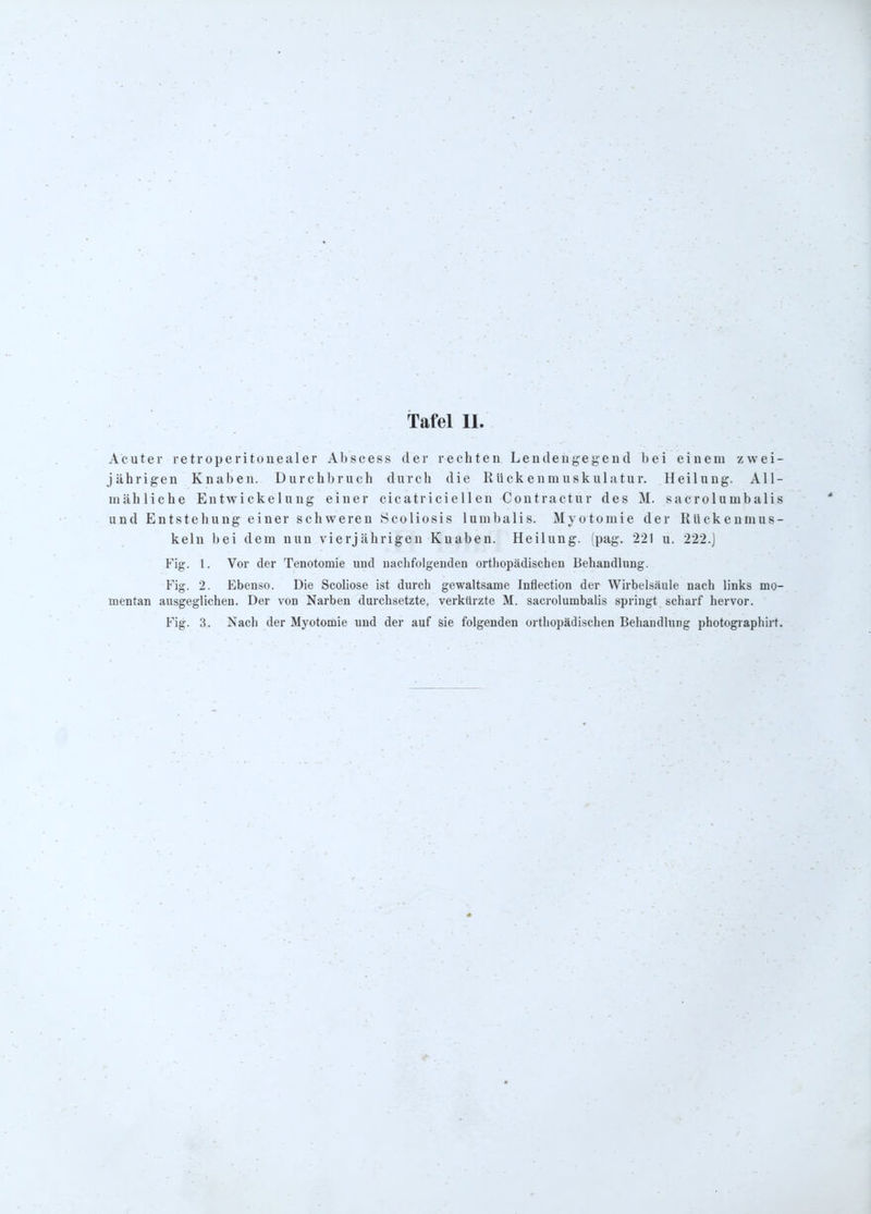 Acuter retroperitonealer Abscess der rechten Lendengegend bei einem zwei- jährigen Knaben. Durchbruch durch die Rückenmuskulatur. Heilung. All- m<ähliche Entwickelung einer cicatriciellen Coutractur des M. sacrolumbalis und Entstehung einer schweren Scoliosis lumbalis. Myotomie der Rückenmus- keln bei dem nun vierjährigen Knaben. Heilung, (pag. 221 u. 222.j Fig. 1. Vor der Tenotomie und iiaclifolgenden orthopädischen Behandlung. Fig. 2. Ebenso. Die Scoliose ist durch gewaltsame Inflection der Wirbelsäule nach links mo- mentan ausgeglichen. Der von Narben durchsetzte, verkürzte M. sacrolumbalis springt scharf hervor.