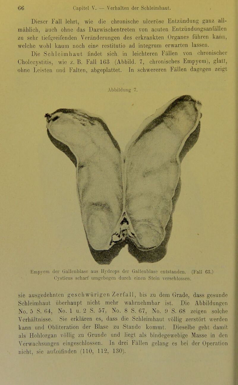 Dieser Fall lehrt, wie die chronische ulceröso Entzündung ganz all- nnählich, auch ohne das Dazwischentreten von acuten Entzündungsanfälien zu sehr liefgreifenden Veränderungen des erkrankten Organes führen kann, welciie wohl kaum noch eino. restitutio ad integrum erwarten lassen. Die Schleimhaut lindet sich, in leichteren Fällen von chronischer Cholecystitis, wie z. B. Fall 163 (Abbild. 7, chronisches Empyem), glatt, ohne Leisten und Falten, abgeplattet. In schwereren Fällen dagegen zeigt Abbildung 7. Empyem der (iallenblasc aus lijdrops der Gallenblase entstanden. (Fall 63.) Cysticus scharf umgebogen durch einen Stein verschlossen. .sie ausgedehnten geschwürigen Zerfall, bis zu dem Grade, dass gesunde Schleimhaut überhaupt nicht mehr wahrnehmbar ist. Die Abbildungen No. 5 S. 64, No. 1 u. 2 S. 57, No. 8 S. 67, No. 9 S. 68 zeigen solche Verhältnisse. Sie erklären es, dass die Schleimhaut völlig zerstört werden kann und Obliteration der Blase zu Stande kommt. Dieselbe gehl damit als Hohlorgan völlig zu Grunde und liegt als bindegewebige Masse in den Verwachsungen eingeschlossen. In drei Fällen gelang es bei der Operation nicht, sie aufzufinden (110, 112, 130).