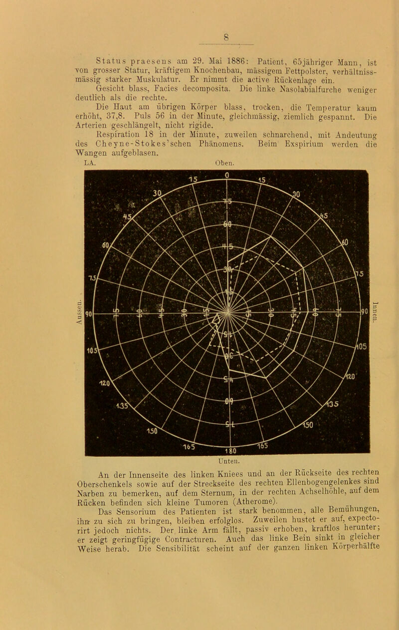 Status praesens am 29. Mai 1886: Patient, 65jähriger Mann, ist ■von grosser Statur, kräftigem Knochenbau, massigem Fettpolster, verhältniss- mässig starker Muskulatur. Er nimmt die active Rückenlage ein. Gesicht blass, Facies decomposita. Die linke Nasolabialfurche weniger deutlich als die rechte. Die Haut am übrigen Körper blass, trocken, die Temperatur kaum erhöht, 37,8. Puls 56 in der Minute, gleichmässig, ziemlich gespannt. Die Arterien geschlängelt, nicht rigide. Respiration 18 in der Minute, zuweilen schnarchend, mit Andeutung des Cheyne-Stokes’sehen Phänomens. Beim Exspirium werden die Wangen aufgeblasen. LA. Oben. Unten. An der Innenseite des linken Kniees und au der Rückseite des rechten Oberschenkels sowie auf der Streckseite des rechten Ellenbogengelenkes sind Narben zu bemerken, auf dem Sternum, in der rechten Achselhöhle, auf dem Rücken befinden sich kleine Tumoren (Atherome). Das Sensorium des Patienten ist stark benommen, alle Bemühungen, ihn zu sich zu bringen, bleiben erfolglos. Zuweilen hustet er auf, expecto- rirt jedoch nichts. Der linke Arm fällt, passiv erhoben, kraftlos herunter, er zeigt geringfügige Contracturen. Auch das linke Bein sinkt in gleicher Weise herab. Die Sensibilität scheint auf der ganzen linken Korperhälfte
