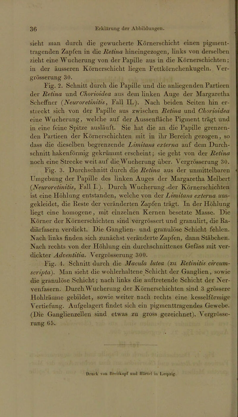 sieht man durch die gewucherte Körnerschicht einen pigment- tragenden Zapfen in die Retina hineingezogen, links von derselben zieht eine Wucherung von der Papille aus in die Körnerschichten; in der äusseren Körnerschicht liegen Fettkörnchenkugeln. Ver- grösserung 30. Fig. 2. Schnitt durch die Papille und die anliegenden Partieen der Retina und Chorioiilea aus dem linken Auge der Margaretha Scheffncr (Neuroretinitis, Fall II.). Nach beiden Seiten hin er- streckt sich von der Papille aus zwischen Retina und Chorioidea eine Wucherung, welche auf der Aussenfläche Pigment trägt und in eine feine Spitze ausläuft. Sie hat die an die Papille grenzen- den Partieen der Körnerschichten mit in ihr Bereich gezogen, so dass die dieselben begrenzende Limitans externa auf dem Durch- schnitt hakenförmig gekrümmt erscheint; sie geht von der Retina noch eine Strecke weit auf die Wucherung über. Vergrösserung 30. Fig. 3. Durchschnitt durch die Retina aus der unmittelbaren Umgebung der Papille des linken Auges der Margaretha Melbert (Neuroretinitis, Fall I.). Durch Wucherung-der Körnerschichten ist eine Höhlung entstanden, welche von der Limitans externa aus- gekleidet, die Reste der veränderten Zapfen trägt. In der Höhlung liegt eine homogene, mit einzelnen Kernen besetzte Masse. Die Körner der Körnerschichten sind vergrössert und granulirt, die Ra- diärfasern verdickt. Die Ganglien- und granulöse Schicht fehlen. Nach links finden sich zunächst veränderte Zapfen, dann Stäbchen. Nach rechts von der Höhlung ein durchschnittenes Gefäss mit ver- dickter Adventitia. Vergrösserung 300. Fig. 4. Schnitt durch die Macula lutea (zu Retinitis circum- scripta). Man sieht die Avohlerhaltene Schicht der Ganglien, sowie die granulöse Schicht; nach links die auftretende Schicht der Ner- venfasern. Durch Wucherung der Körnerschichten sind 3 grössere Plohlräumc gebildet, sowie weiter nach rechts eine kesselförmige Vertiefung. Aufgelagert findet sich ein pigmenttragendes Gewebe. (Die Ganglienzellen sind etwas zu gross gezeichnet). Vergrösse- rung 65. Druck von liivilkopf und HUrlid in Lctpzig.