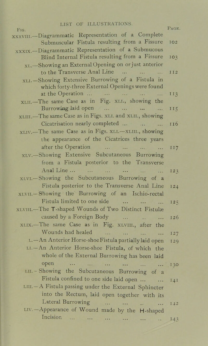 Fig. XXXVIII.—Diagrammatic Representation of a Complete Submuscular Fistula resulting from a Fissure XXXIX.— Diagrammatic Representation of a Submucous Blind Internal Fistula resulting from a Fissure xr,.—Showing an External Opening on or just anterior to the Transverse Anal Line XLi.—Showing Extensive Burrowing of a Fistula in which forty-three External Openings were found at the Operation ... XLii.—The same Case as in Fig. xli., showing the Burrowing laid open XLiii.—The same Case as in Figs. xli. and xlil, showing Cicatrisation nearly completed ... xLiv.—The same Case as in Figs. xli.—xliil, showing the appearance of the Cicatrices three years after the Operation XLV.—Showing Extensive Subcutaneous Burrowing from a Fistula posterior to the Transverse Anal Line ... XLVi.— Showing the Subcutaneous Burrowing of a Fistula posterior to the Transverse Anal Line XL\ iL—Showing the Burrowing of an Ischio-rectal Fistula limited to one side XLt iii.—The T-shaped Wounds of Two Distinct Fistulae caused by a Foreign Body XLix.—The same Case as in Fig. xlvul, after the Wounds had healed L.—An Anterior Horse-shoe Fistula partially laid open LI.—An Anterior Horse-shoe Fistula, of which the whole of the External Burrowing has been laid open Lii.-Showing the Subcutaneous Burrowing of a Fistula confined to one side laid open LiiL —A Fistula passing under the External Sphincter into the Rectum, laid open together with its Lateral Burrowing Liv.—Appearance of Wound made by the H-shaped Incision Page. 102 103 I 12 II3 115 116 117 123 124 125 126 127 I 29 . 130 I4I ia2 143