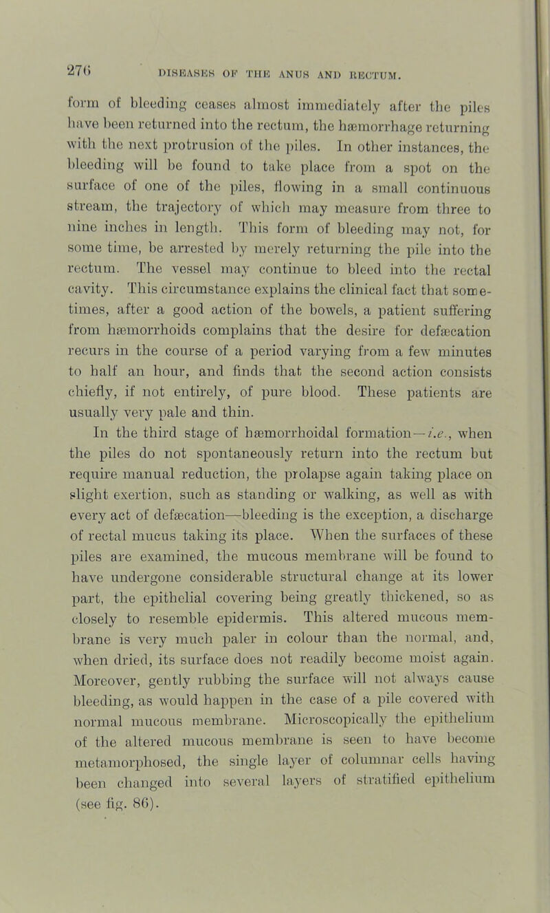 i^7(» DIHI5AKKK OK THK ANUH AND 1U5CTUM. form of bleeding ceasen almost immediately after the piles have been returned into the rectum, the ha3inorrhage returning with the next protrusion of the piles. In other instances, the bleeding will he found to take place from a sj:)ot on the surface of one of the piles, flowing in a small continuous stream, the trajectory of which may measure from three to nine inches in length. This form of bleeding may not, for some time, he arrested by merely returning the pile into the rectum. The vessel may continue to bleed into the rectal cavity. This circumstance explains the clinical fact that some- times, after a good action of the bowels, a patient suffering from hEemorrhoids complains that the desire for defaecation recurs in the course of a period varying from a few minutes to half an hour, and finds that the second action consists chiefly, if not entirely, of pure blood. These patients are usually very pale and thin. In the third stage of haemorrhoidal formation—/.^., when the piles do not spontaneously return into the rectum but require manual reduction, the prolapse again taking place on slight exertion, such as standing or walking, as well as with every act of defaecation-—^bleeding is the exception, a discharge of rectal mucus taking its place. When the surfaces of these piles are examined, the mucous membrane will be found to have undergone considerable structural change at its lower part, the epithelial covering being greatly thickened, so as closely to resemble epidermis. This altered mucous mem- brane is very much paler in colour than the normEil, tind, when dried, its surface does not readily become moist again. Moreover, gently rubbing the surface will not alwa3's cause bleeding, as would happen in the case of a pile covered with normal mucous membrane. Microscopically the epithelium of the altered mucous membrane is seen to have become uietEimorphosed, the single lawyer of columnar cells having been changed into several layers of stratified epithelium (see fig. 86).