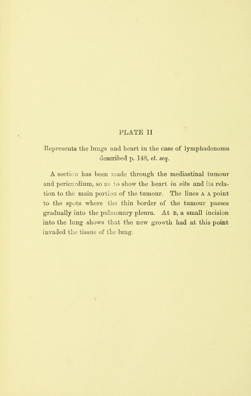 Represents the lungs and heart in the case of lymphadenoma described p. 148, et. seq. A section has been made through the mediastinal tumour and pericardium, so as to show the heart in situ and its rela- tion to the main portion of the tumour. The lines A A point to the spots where the thin border of the tumour passes gradually into the pulmonary pleura. At B, a small incision into the lung shows that the new growth had at this point invaded the tissue of the lung.