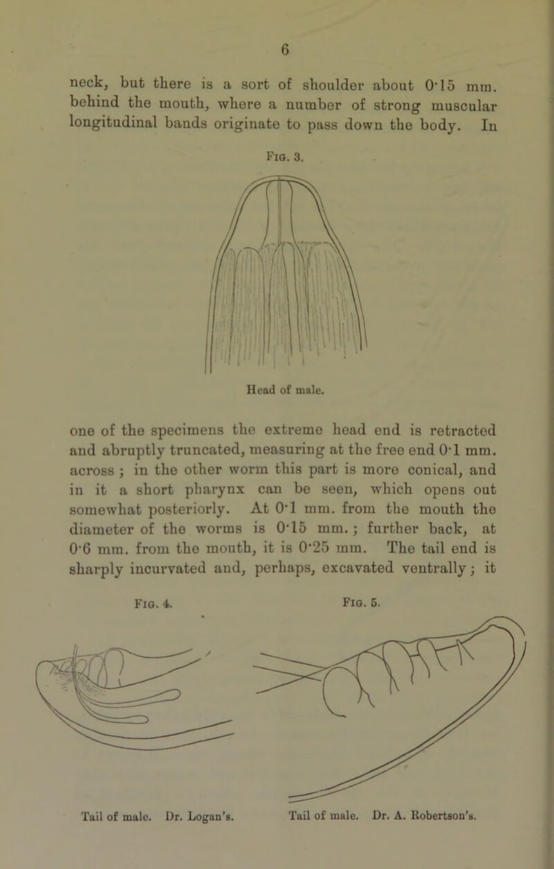 neck, but there is a sort of shoulder about O’15 mm. behind the mouth, where a number of strong muscular longitudinal bauds originate to pass down the body. In Fig. 3. one of the specimens the extreme head end is retracted and abruptly truncated, measuring at the free end 0’1 mm. across ; in the other worm this part is more conical, and in it a short pharynx can be seen, which opens out somewhat posteriorly. At 0’1 mm. from the mouth the diameter of the worms is O'15 mm. ; further back, at 0’6 mm. from the mouth, it is 0’25 mm. The tail end is sharply incurvated and, perhaps, excavated ventrally; it Fig. 4. Fig. 5. Tail of male. Dr. Logan’s. Tail of male. Dr. A. Robertson’s.