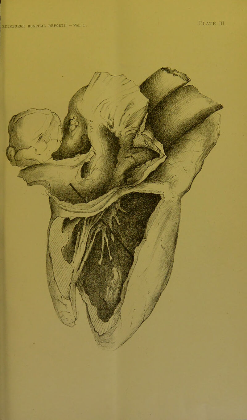 EDINBTJRGH BOSPITAL REPORTS .-Vol. 1. Plate ill