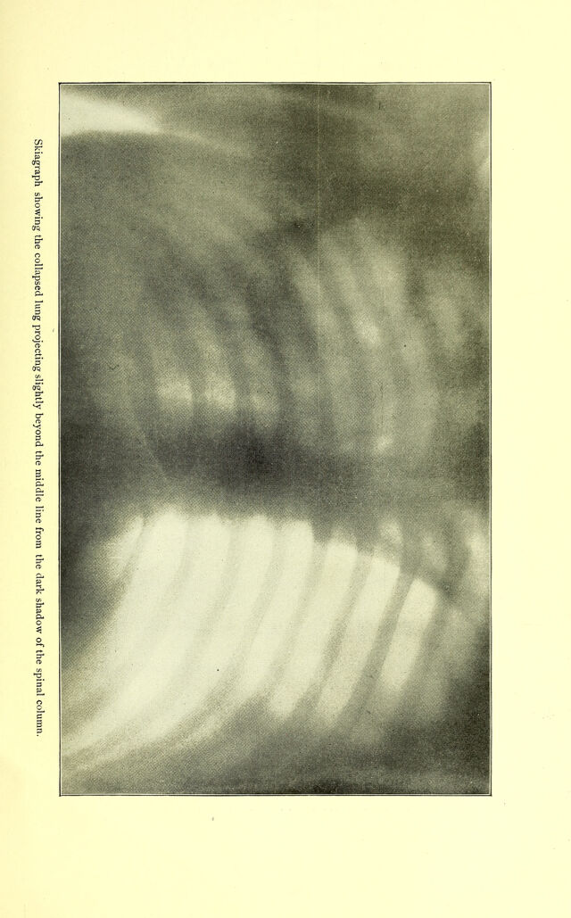 digitised image 3