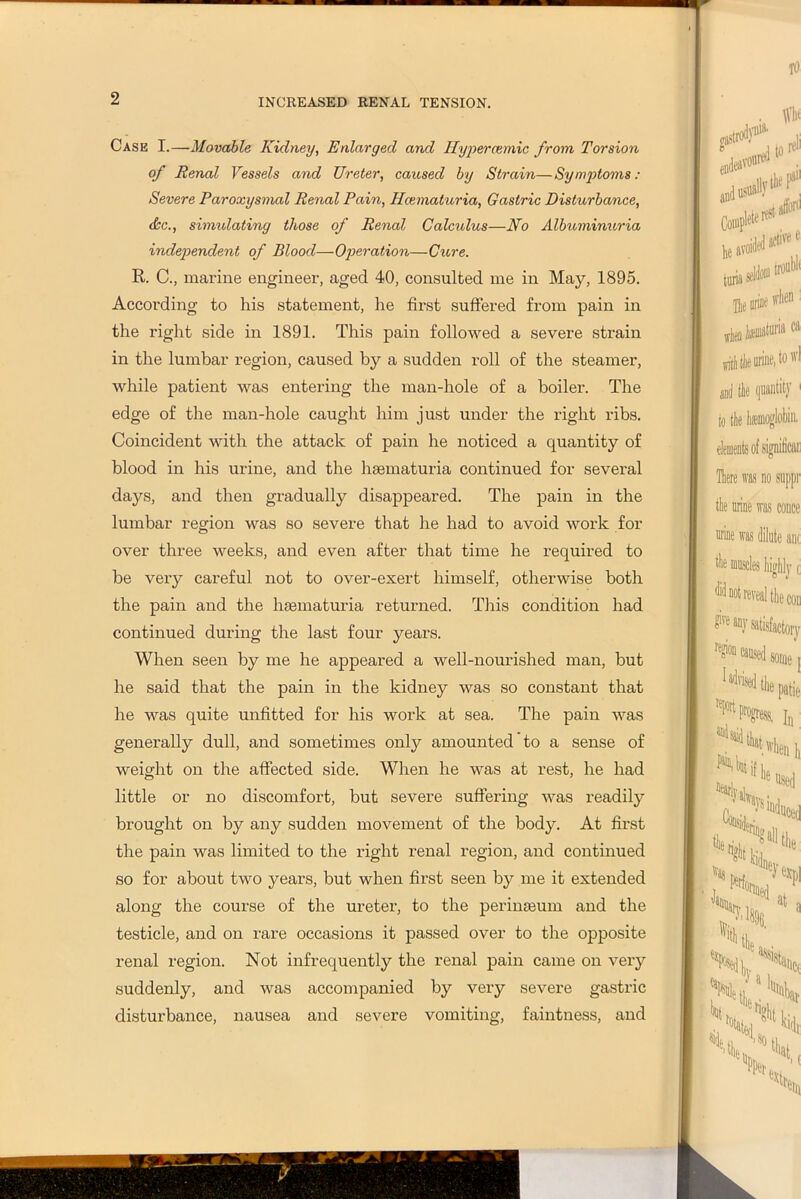 Case I.—Movable Kidney, Enlarged and Hyperrcemic from Torsion of Renal Vessels and Ureter, caused by Strain—Sym2Jtoms: Severe Paroxysmal Renal Pain, Hcematuria, Gastric Disturbance, <bc., simulating those of Renal Calculus—No Albuminuria independent of Blood—Ojieration—Ciore. E. C., marine engineer, aged 40, consulted me in May, 1895. According to his statement, he first suffered from pain in the right side in 1891. This pain followed a severe strain in the lumbar region, caused by a sudden roll of the steamer, while patient was entering the man-hole of a boiler. The edge of the man-hole caught him just under the right ribs. Coincident with the attack of pain he noticed a quantity of blood in his urine, and the haematuria continued for several days, and then gradually disappeared. The pain in the lumbar region was so severe that he had to avoid work for over three weeks, and even after that time he required to be very careful not to over-exert himself, otherwise both the pain and the haematuria returned. Tliis condition had continued during the last four years. When seen by me he appeared a well-nourished man, but he said that the pain in the kidney was so constant that he was quite unfitted for his work at sea. The pain was generally dull, and sometimes only amounted to a sense of weight on the affected side. When he was at rest, he had little or no discomfort, but severe suffering was readily brought on by any sudden movement of the body. At first the pain was limited to the right renal region, and continued so for about two years, but when first seen by me it extended along the course of the ureter, to the perinmum and the testicle, and on rare occasions it passed over to the opposite renal region. Not infrequently the renal pain came on very suddenly, and was accompanied by very severe gastric disturbance, nausea and severe vomiting, faintness, and