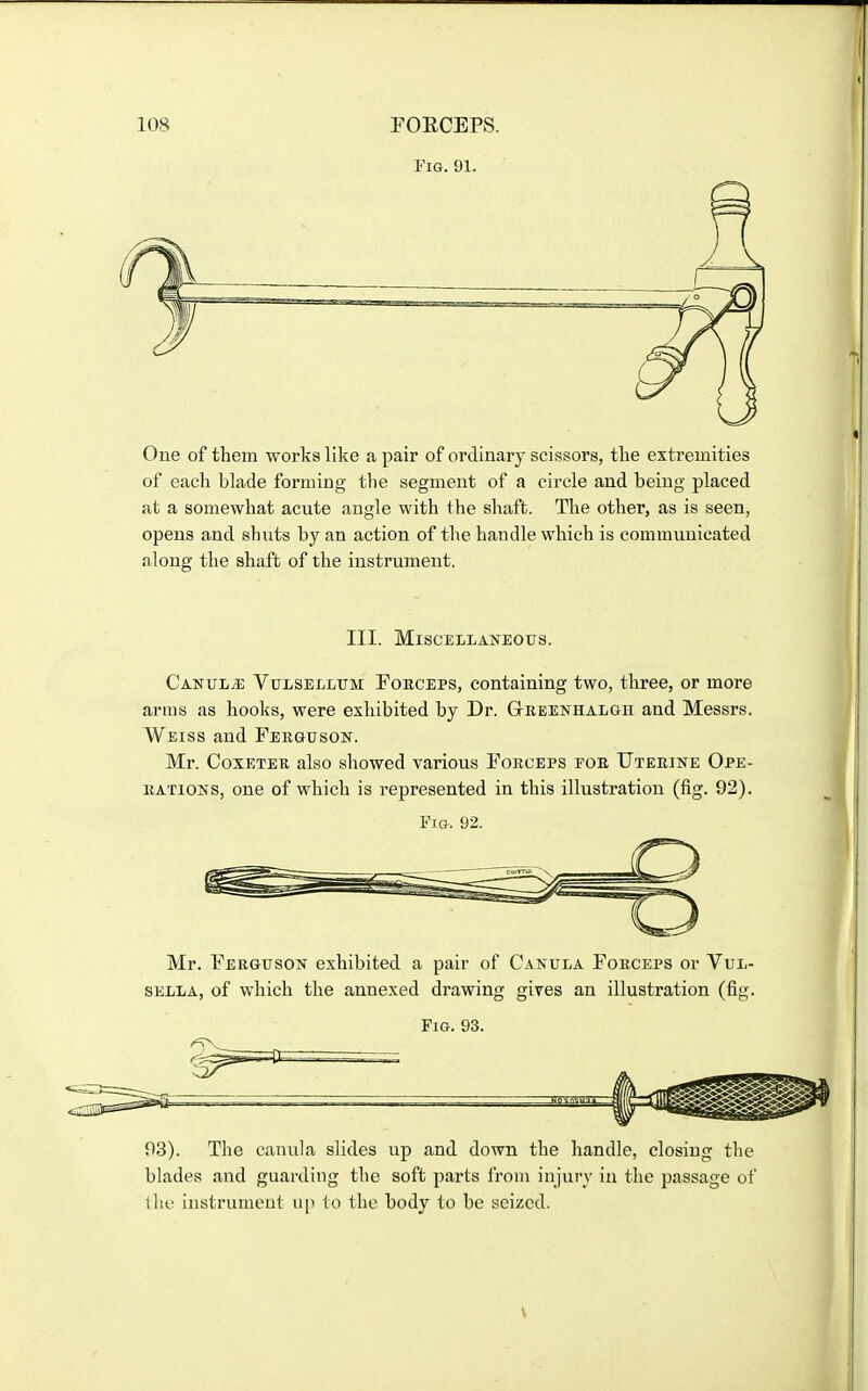 Fig. 91. One of them works like a pair of ordinary scissors, tlie extremities of each blade forming the segment of a circle and being placed at a somewhat acute angle with the shaft. The other, as is seen, opens and shuts by an action of the handle which is communicated along the shaft of the instrument. III. Miscellaneous. Canul^ Vulsellum Foeceps, containing two, three, or more arms as hooks, were exhibited by Dr. Greenhalgii and Messrs. Weiss and Ferguson. Mr. CoxETER also showed various Forceps for Uterine Ope- rations, one of which is represented in this illustration (fig. 92). Fi&. 92. Mr. Ferguson exhibited a pair of Canula Forceps or Vul- sella, of which the annexed drawing gives an illustration (fig. Fig. 93. 03). The canula slides up and down the handle, closing the blades and guarding the soft parts from injury in the passage of llie instrument up to the body to be seized.