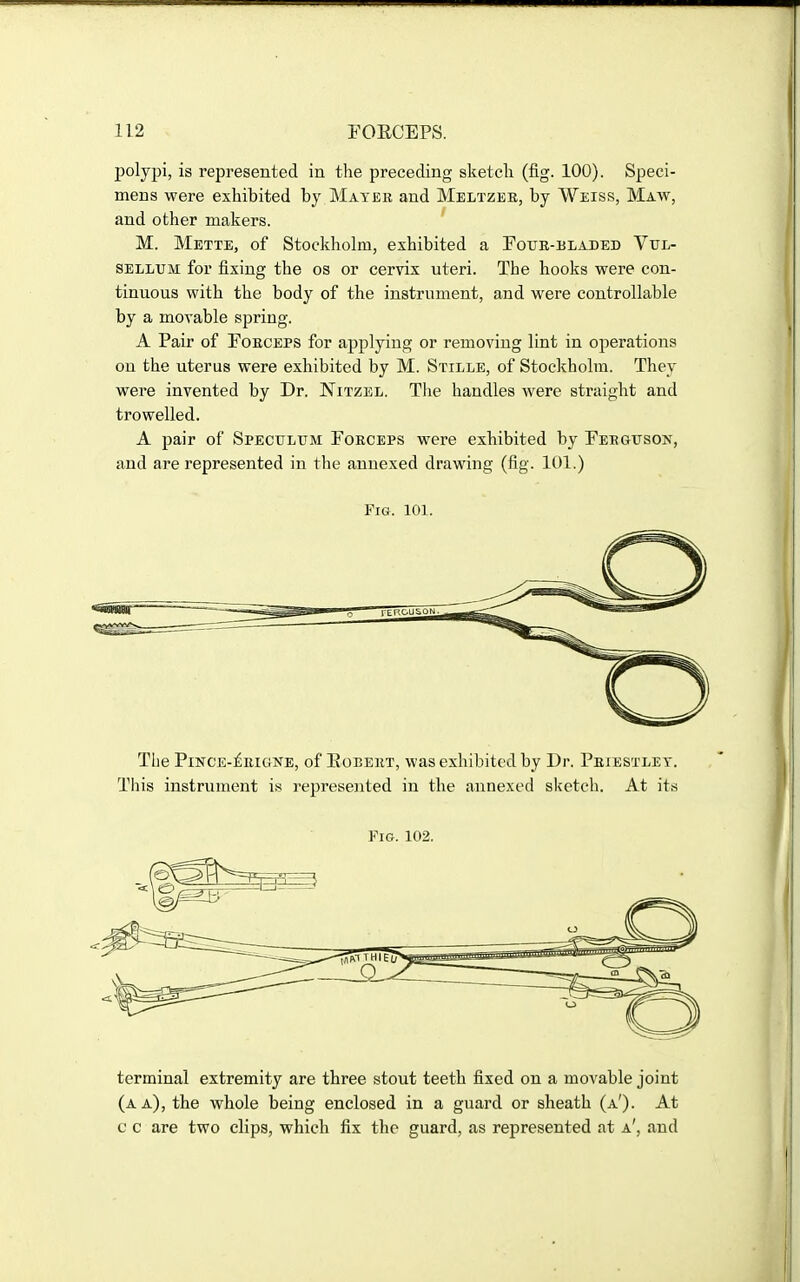 polypi, is represented in the preceding sketcli (fig. 100). Speci- mens were exhibited by Mater and Meltzee, by Weiss, Maw, and other makers. M. Mette, of Stockholm, exhibited a Pour-bladed Vttl- SELiiUM for fixing the os or cervix uteri. The hooks were con- tinuous with the body of the instrument, and were controllable by a movable spring. A Pair of Forceps for applying or removing lint in operations on the uterus were exhibited by M. Stille, of Stockholm. They were invented by Dr. Nitzel. Tlie handles were straight and trowelled. A pair of Speculum Forceps were exhibited by Ferguson, and are represented in the annexed drawing (fig. 101.) Fig. 101. The Pince-£eigne, of Egbert, was exhibited by Ur. Priestley. This instrument is represented in the annexed sketch. At Pig. 102. terminal extremity are three stout teeth fixed on a movable joint (a a), the whole being enclosed in a guard or sheath (a'). At c c are two clips, which fix the guard, as represented at a', and