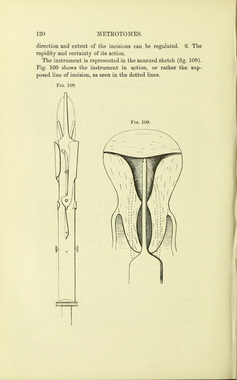 direction and extent of the incisions can be regulated. 6. The rapidity and certainty of its action. The instrument is represented in the annexed sketch (fig. 108). Pig. 109 shows the instrument in action, or rather the sup- posed line of incision, as seen in the dotted lines. Fig. 108.