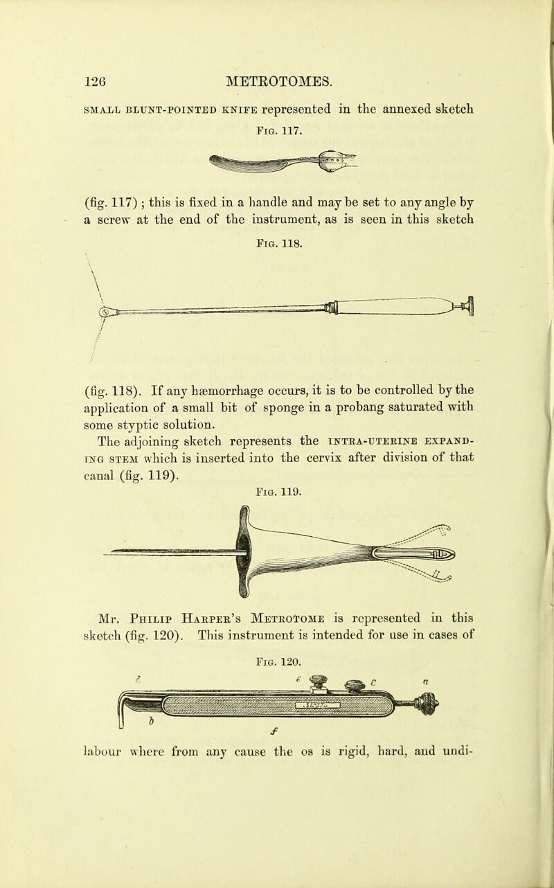 SMALL BLUNT-POINTED KNIFE represented in the annexed sketcli Fig. 117. (fig. 117) ; this is fixed in a handle and maybe set to any angle by a screw at the end of the instrument, as is seen in this sketch Fia. 118. (fig. 118). If any haemorrhage occurs, it is to be controlled by the application of a small bit of sponge in a probang saturated with some styptic solution. The adjoining sketch represents the tntea-tjteexne expand- ing STEM which is inserted into the cervix after division of that canal (fig. 119). Fig. 119. Mr. Philip Hakper's Metrotome is represented in this sketch (fig. 120). This instrument is intended for use in cases of Fig. 120. 1 \ labour where from any cause the os is rigid, hard, and undi-