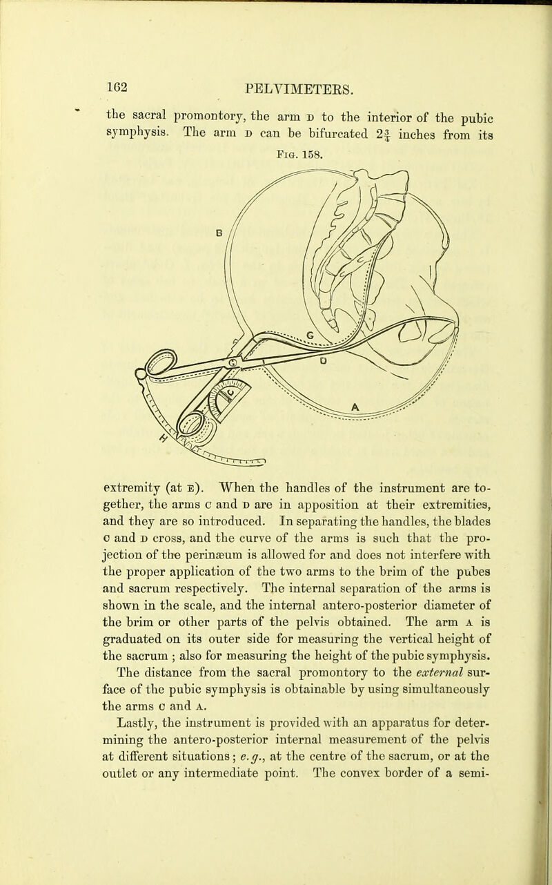 the sacral promontoiy, the arm d to the interior of the pubic symphysis. The arm d can be bifurcated 2|- inches from its Fia. 158. extremity (at e). When the handles of the instrument are to- gether, the arms c and d are in apposition at their extremities, and they are so introduced. In separating the handles, the blades 0 and D cross, and the curve of the arms is such that the pro- jection of the perinseum is allowed for and does not interfere with the proper application of the two arms to the brim of the pubea and sacrum respectively. The internal separation of the arms is shown in the scale, and the internal antero-posterior diameter of the brim or other parts of the pelvis obtained. The arm A is graduated on its outer side for measuring the vertical height of the sacrum ; also for measuring the height of the pubic symphysis. The distance from the sacral promontory to the external sur- face of the pubic symphysis is obtainable by using simultaneously the arms c and A. Lastly, the instrument is provided with an apparatus for deter- mining the antero-posterior internal measurement of the pelvis at different situations ; e.ff., at the centre of the sacrum, or at the outlet or any intermediate point. The convex border of a semi-