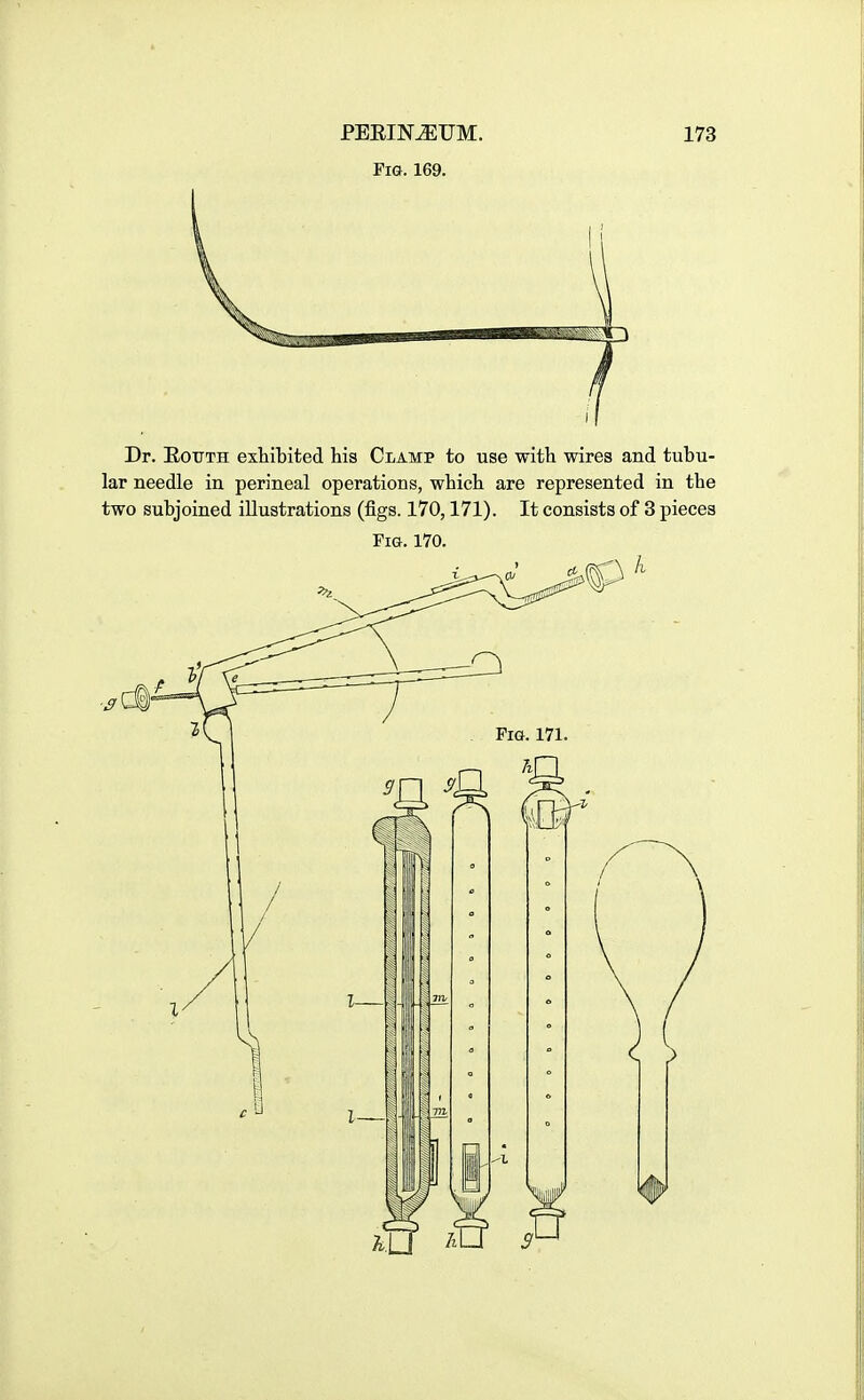 Fig. 169. Dr. E.0T7TH exhibited his Clamp to use with wires and tubu- lar needle in perineal operations, which are represented in the two subjoined illustrations (figs. 170,171). It consists of 3 pieces