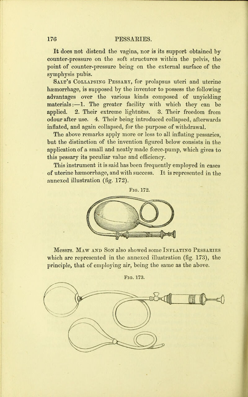 It does not distend the vagina, nor is its support obtained by counter-pressure on the soft structures within the pelvis, the point of counter-pressure being on the external surface of the symphysis pubis. Salt's Collapsing Pessaet, for prolapsus uteri and uterine haemorrhage, is supposed by the inventor to possess the following advantages over the various kinds composed of unyielding materials:—1. The greater facility with which they can be applied. 2. Their extreme lightness. 3. Their freedom from odour after use. 4. Their being introduced collapsed, afterwards inflated, and again collapsed, for the purpose of withdrawal. The above remarks apply more or less to all inflating pessaries, but the distinction of the invention figured below consists in the application of a small and neatly made force-pump, which gives to this pessary its peculiar value and efficiency. This instrument it is said has been frequently employed in cases of uterine haemorrhage, and with success. It is represented in the annexed illustration (fig. 172). Fig. 172. Messrs. Maw and Son also showed some Inflating Pessaeies which are represented in the annexed illustration (fig. 173), the principle, that of employing air, being the same as the above. Pig. 173.