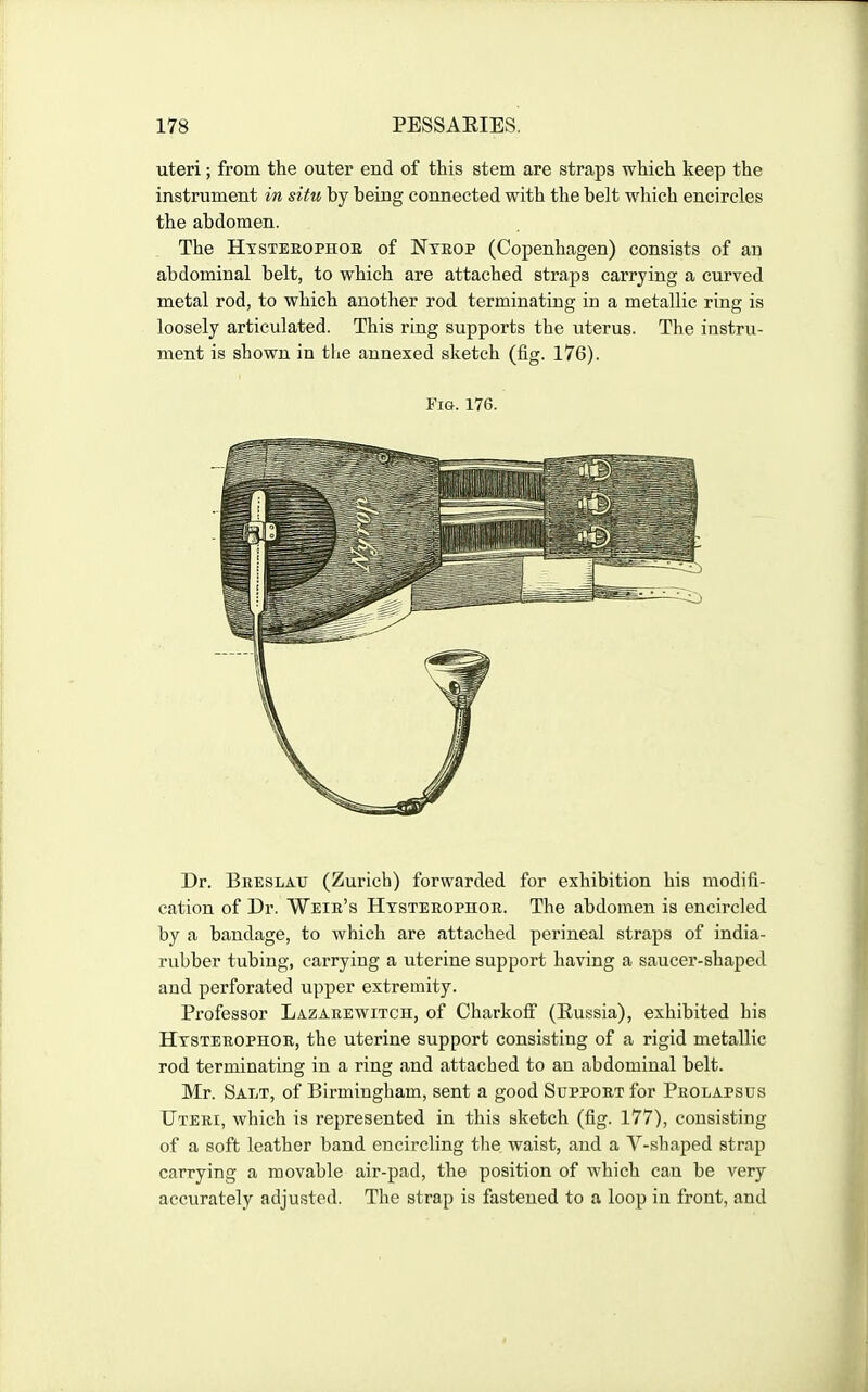 uteri; from the outer end of this stem are straps which keep the instrument in situ by being connected with the belt which encircles the abdomen. The Htsteeophoe of Ntbop (Copenhagen) consists of an abdominal belt, to which are attached straps carrying a curved metal rod, to which another rod terminating in a metallic ring is loosely articulated. This ring supports the uterus. The instru- ment is shown in the annexed sketch (fig. 176). Fig. 176. Dr. Breslau (Zurich) forwarded for exhibition his modifi- cation of Dr. Weib's Htsterophor. The abdomen is encircled by a bandage, to which are attached perineal straps of india- rubber tubing, carrying a uterine support having a saucer-shaped and perforated upper extremity. Professor Lazarewitch, of Charkoff (Eussia), exhibited his Htsterophor, the uterine support consisting of a rigid metallic rod terminating in a ring and attached to an abdominal belt. Mr. Salt, of Birmingham, sent a good Support for Prolapsus Uteri, which is represented in this sketch (fig. 177), consisting of a soft leather band encircling tlie waist, and a V-shaped strap carrying a movable air-pad, the position of which can be very accurately adjusted. The strap is fastened to a loop in front, and