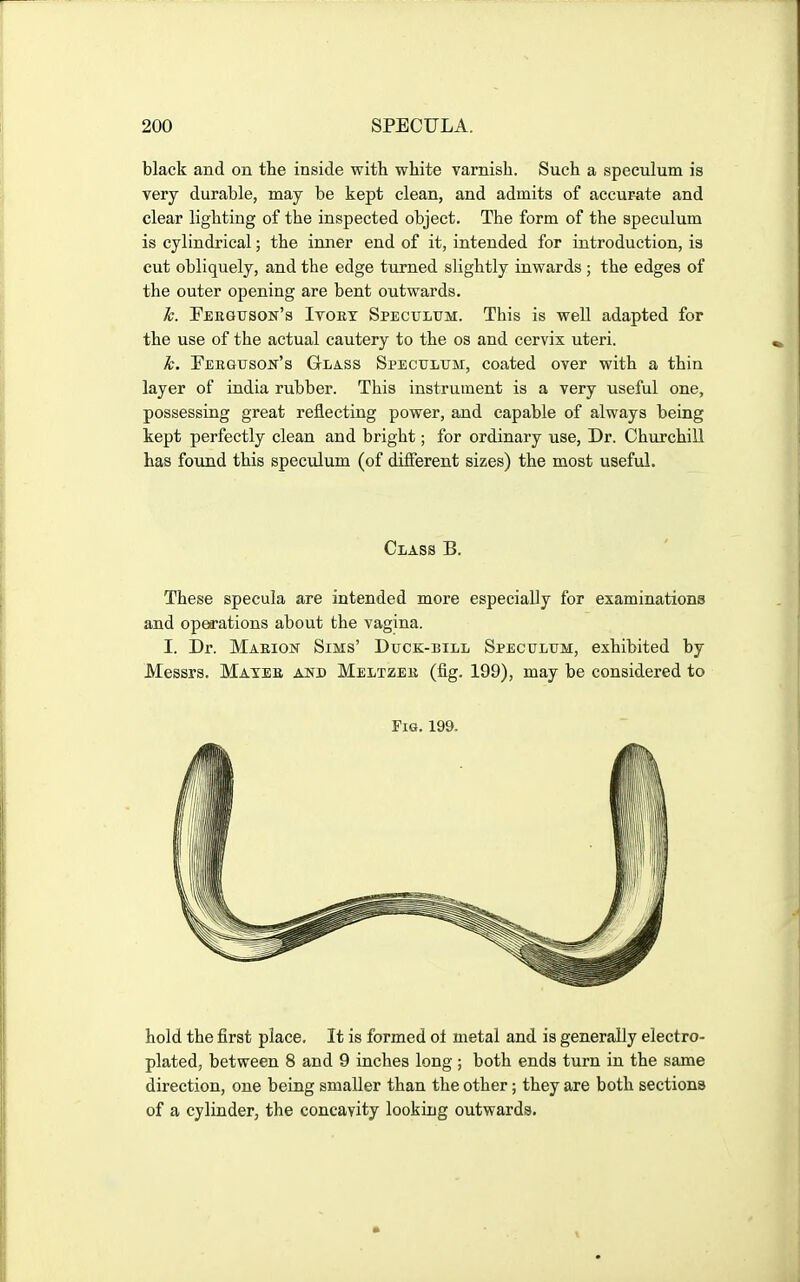 black and on the inside with white varnish. Such a speculum is very durable, may be kept clean, and admits of accurate and clear lighting of the inspected object. The form of the speculum is cylindrical; the inner end of it, intended for introduction, is cut obliquely, and the edge turned slightly inwards ; the edges of the outer opening are bent outwards. k. Ferguson's Ivoey Speculum. This is well adapted for the use of the actual cautery to the os and cervix uteri. k. Ferguson's Glass Speculum, coated over with a thin layer of india rubber. This instrument is a very useful one, possessing great reflecting power, and capable of always being kept perfectly clean and bright; for ordinary use. Dr. Churchill has found this speculum (of different sizes) the most useful. Class B. These specula are intended more especially for examinations and operations about the vagina. I. Dr. Maeion Sims' Duck-bill Speculum, exhibited by Messrs. Matee and Meltzee (iig. 199), may be considered to Fig. 199. hold the first place. It is formed ol metal and is generally electro- plated, between 8 and 9 inches long; both ends turn in the same direction, one being smaller than the other; they are both sections of a cylinder, the concavity looking outwards.