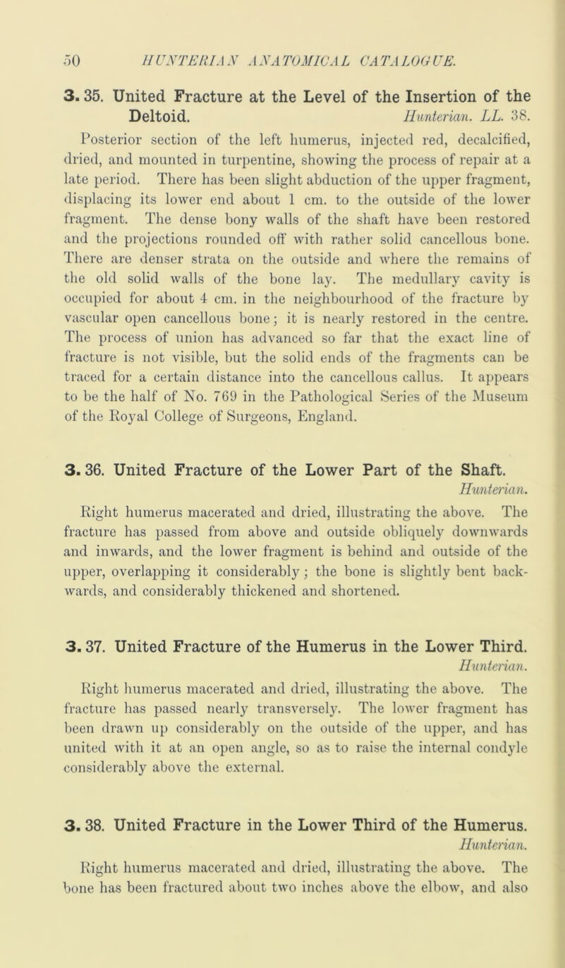 3.35. United Fracture at the Level of the Insertion of the Deltoid. Hunterian. LL. 38. Posterior section of the left humerus, injected red, decalcified, dried, and mounted in turpentine, showing the process of repair at a late period. There has been slight abduction of the upper fragment, <lisplacing its lower end about 1 cm. to the outside of the lower fragment. The dense bony walls of the shaft have been restored and the projections rounded off with rather solid cancellous bone. There are denser strata on the outside and where the remains of the old solid walls of the bone lay. The medullary cavity is occupied for about 4 cm. in the neighbourhood of the fracture by vascular open cancellous bone; it is nearly restored in the centre. The process of union has advanced so far that the exact line of fracture is not visible, but the solid ends of the fragments can be traced for a certain distance into the cancellous callus. It appears to be the half of No. 769 in the Pathological Series of the Museum of the Eoyal College of Surgeons, England. 3.36. United Fracture of the Lower Part of the Shaft. Hunterian. Right humerus macerated and dried, illustrating the above. The fracture has passed from above and outside oblicpiely downwards and inwards, and the lower fragment is behind and outside of the upper, overlapping it considerably the bone is slightly bent back- wards, and considerably thickened and shortened. 3.37. United Fracture of the Humerus in the Lower Third. Hunterian. Right humerus macerated and dried, illustrating the above. The fracture has passed nearly transversel}^ The lower fragment has been drawn up considerably on the outside of the upper, and has united with it at an open angle, so as to raise the internal condyle considerably above the external. 3.38. United Fracture in the Lower Third of the Humerus. Hunterian. Eight humerus macerated and dried, illustrating the above. The bone has been fractured about two inches above the elbow, and also