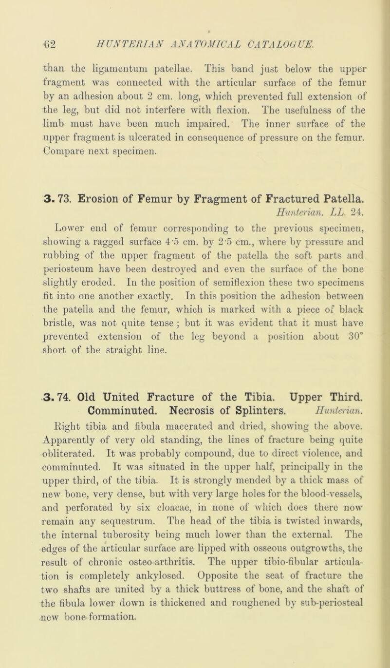than the ligamentuiu patellae. This band just below the upper fragment was connected with the articular surface of the femur by an adhesion about 2 cm. long, which prevented full extension of the leg, but did not interfere with flexion. The usefulness of the limb must have been much impaired. The inner surface of the upper fragment is ulcerated in consequence of pressure on the femur. Compare next specimen. 3.73. Erosion of Femur by Fragment of Fractured Patella. Hunterian. LL. 24. Lower end of femur corresponding to the previous specimen, showing a ragged surface 4-5 cm. by 2'5 cm., where by pressure and rubbing of the upper fragment of the patella the soft parts and periosteum have been destroyed and even the surface of the bone slightly eroded. In the position of semiflexion these two specimens fit into one another exactly. In this position the adhesion between the patella and the femur, which is marked with a piece of black bristle, was not quite tense; but it was evident that it must have prevented extension of the leg beyond a position about 30° short of the straight line. 3.74. Old United Fracture of the Tibia. Upper Third. Comminuted. Necrosis of Splinters. Hunterian. Right tibia and fibula macerated and dried, showing the above. Apparently of very old standing, the lines of fracture being quite obliterated. It was probably compound, due to direct violence, and comminuted. It was situated in the upper half, principally in the upper third, of the tibia. It is strongly mended by a thick mass of new bone, very dense, but with very large holes for the blood-vessels, and perforated by six cloacae, in none of which does there now remain any sequestrum. The head of the tibia is twisted inwards, the internal tuberosity being much lower than the external. The edges of the articular surface are lipped with osseous outgrowths, the result of chronic osteo-arthritis. The upper tibio-fibular articula- tion is completely ankylosed. Opposite the seat of fracture the two shafts are united by a thick buttress of bone, and the shaft of the fibula lower down is thickened and roughened by sub-periosteal new bone-formation.