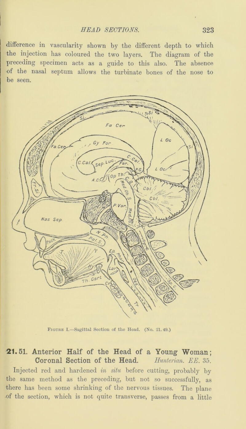 difference in vascularity shown by the different depth to which the injection has coloured the two layers. The diagram of the preceding specimen acts as a guide to this also. The absence of the nasal septum allows the turbinate bones of the nose to be seen. Figure I.—Sagittal Section of the Head. (No. 21. 49.) 21.51. Anterior Half of the Head of a Young Woman; Coronal Section of the Head. Hunterian. EE. 35. Injected red and hardened in situ before cutting, probabl}’’ by the same method as the preceding, but not so successfully, as there has been some shrinking of the nervous tissues. The plane ■of the section, which is not quite transverse, passes from a little