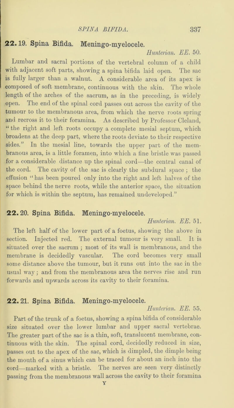 22.19. Spina Bifida. Meningo-myelocele. Hunterian. EE. 50. Lumbar and sacral portions of the vertebral column of a child with adjacent soft parts, showing a spina bifida laid open. The sac is fully larger than a walnut. A considerable area of its apex is composed of soft membrane, continuous with the skin. The whole length of the arches of the sacrum, as in the preceding, is widely open. The end of the spinal cord passes out across the cavity of the tumour to the membranous area, from which the nerve roots spring and recross it to their foramina. As described by Professor Cleland, “ the right and left roots occupy a complete mesial septum, which broadens at the deep part, where the roots deviate to their respective sides.” In the mesial line, towards the upper part of the mem- branous area, is a little foramen, into which a fine bristle was passed for a considerable distance up the spinal cord—the central canal of the cord. The cavity of the sac is clearly the subdural space ; the effusion “has been poured only into the right and left halves of the space behind the nerve roots, while the anterior space, the situation for which is within the septum, has remained undeveloped.” 22.20. Spina Bifida. Meningo-myelocele. Hunterian. EE. 51. The left half of the lower part of a foetus, showing the above in section. Injected red. The external tumour is very small. It is situated over the sacrum ; most of its wall is membranous, and the membrane is decidedly vascular. The cord becomes very small some distance above the tumour, but it runs out into the sac in the usual way; and from the membranous area the nerves rise and run forwards and upwards across its cavity to their foramina. 22.21. Spina Bifida. Meningo-myelocele. Hunterian. EE. 55. Part of the trunk of a foetus, showing a spina bifida of considerable size situated over the lower lumbar and upper sacral vertebrae. The greater part of the sac is a thin, soft, translucent membrane, con- tinuous with the skin. The spinal cord, decidedly reduced in size, passes out to the apex of the sac, which is dimpled, the dimple being the mouth of a sinus which can be traced for about an inch into the cord—marked with a bristle. The nerves are seen very distinctly passing from the membranous wall across the cavity to their foramina Y
