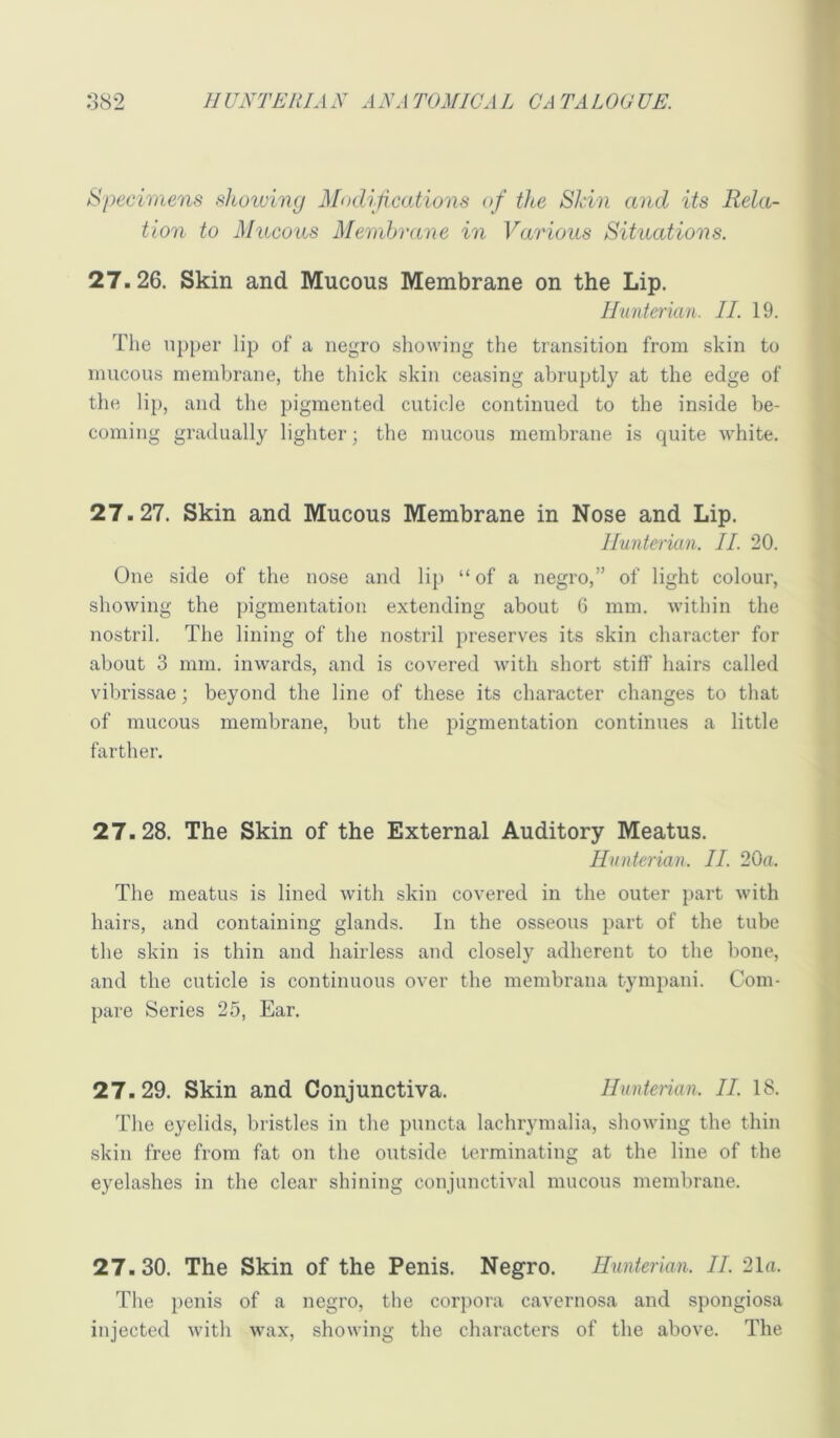 Specimens shoiuing Modifications of the Shin and its Rela- tion to Mucous Membrane in Various Situations. 27.26. Skin and Mucous Membrane on the Lip. Hunter km. II. 19. The npj)er lip of a negro showing the transition from skin to mucous membrane, the thick skin ceasing abruptly at the edge of the lip, and the pigmented cuticle continued to the inside be- coming gradually lighter; the mucous membrane is quite white. 27.27. Skin and Mucous Membrane in Nose and Lip. llunterkin. II. 20. One side of the nose and lip “ of a negro,” of light colour, showing the pigmentation extending about 6 mm. within the nostril. The lining of the nostril preserves its skin character for about 3 mm. inwards, and is covered with short stiff hairs called vibrissae; beyond the line of these its character changes to that of mucous membrane, but the pigmentation continues a little farther. 27.28. The Skin of the External Auditory Meatus. Hunterian. II. 20a. The meatus is lined with skin covered in the outer part with hairs, and containing glands. In the osseous ])art of the tube the skin is thin and hairless and closely adherent to the bone, and the cuticle is continuous over the membrana tympani. Com- pare Series 25, Ear. 27.29. Skin and Conjunctiva. Hunterian. II. 18. The eyelids, bristles in the puncta lachrymalia, showing the thin skin free from fat on the outside terminating at the line of the eyelashes in the clear shining conjunctival mucous membrane. 27.30. The Skin of the Penis. Negro. Hunterian. II. 21a. The penis of a negro, the corpora cavernosa and spongiosa injected with wax, showing the characters of the above. The